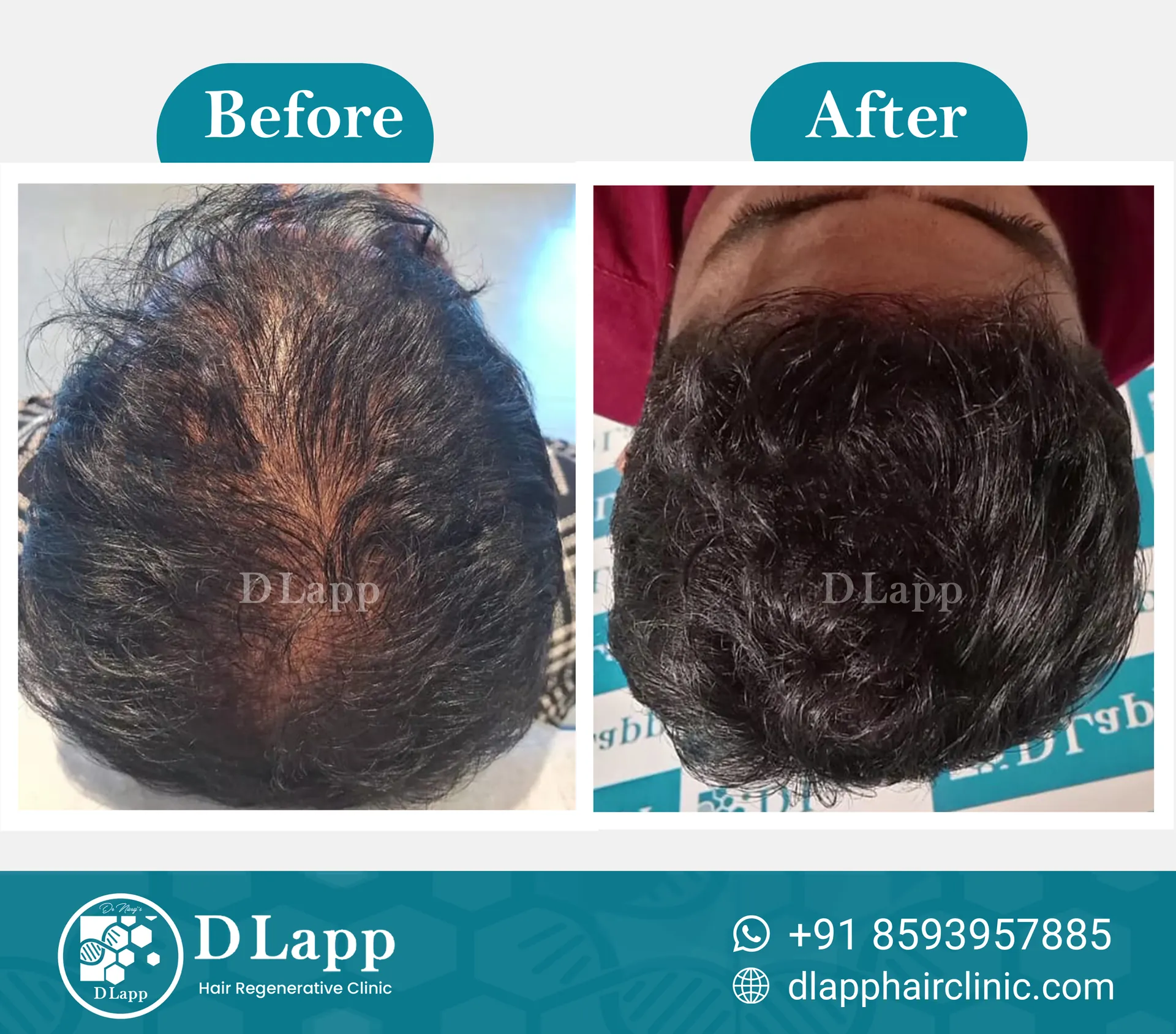 Before/After Medical Image