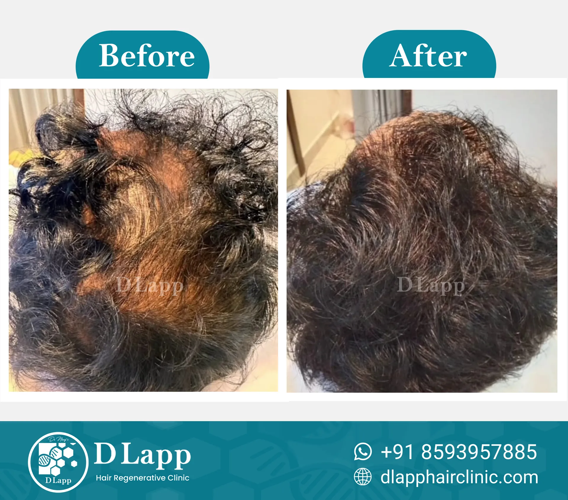 Before/After Medical Image