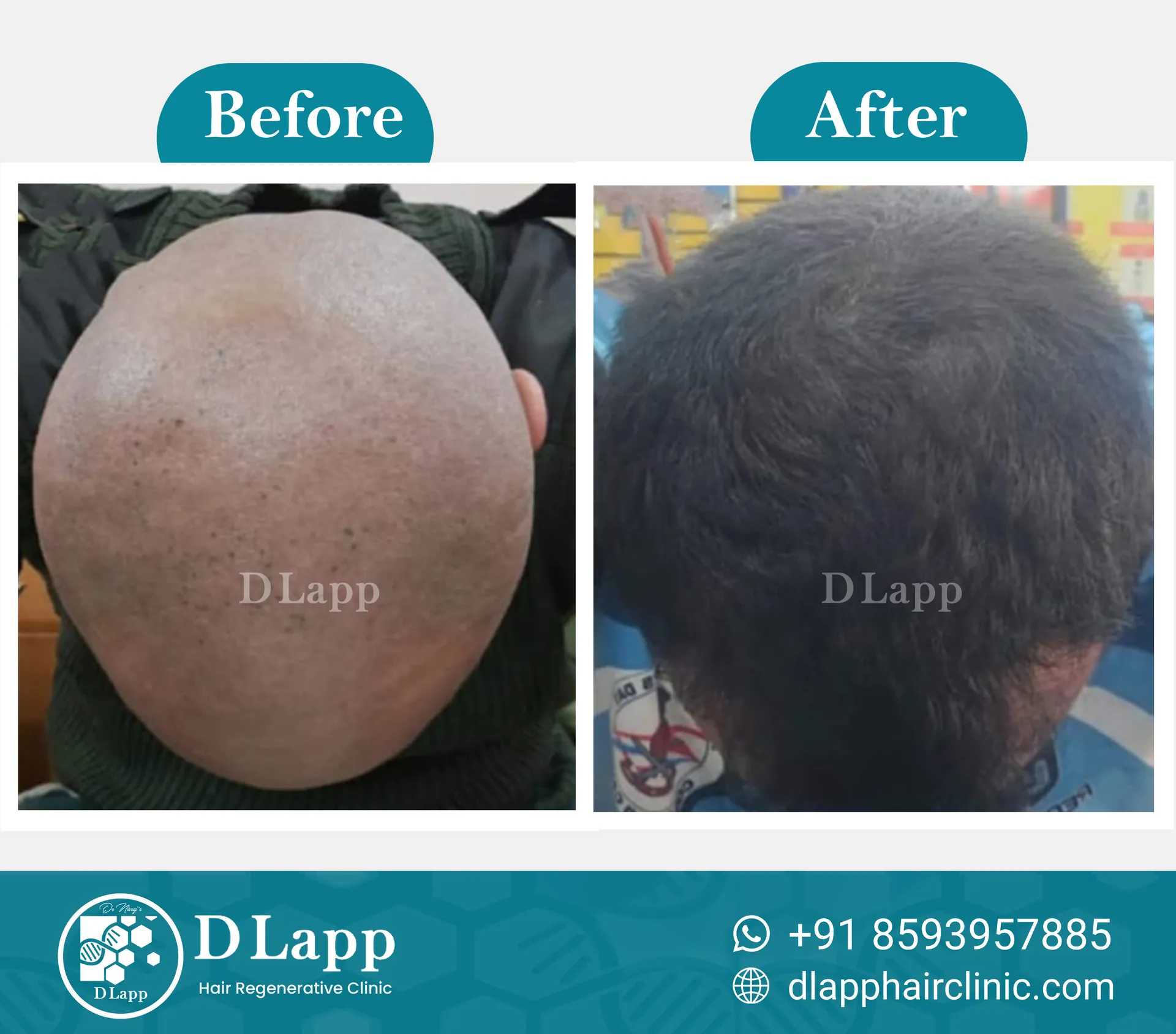 Before/After Medical Image