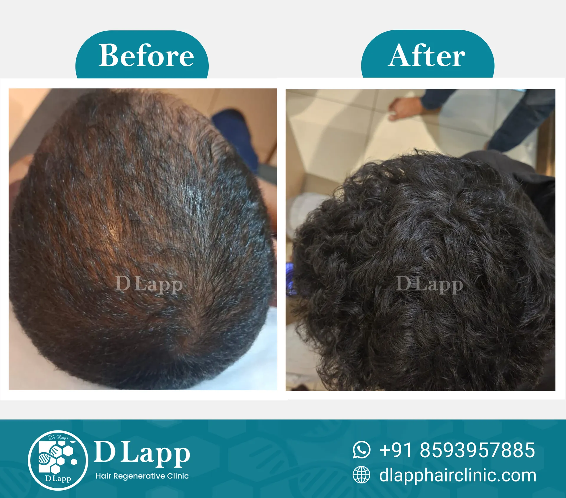 Before/After Medical Image