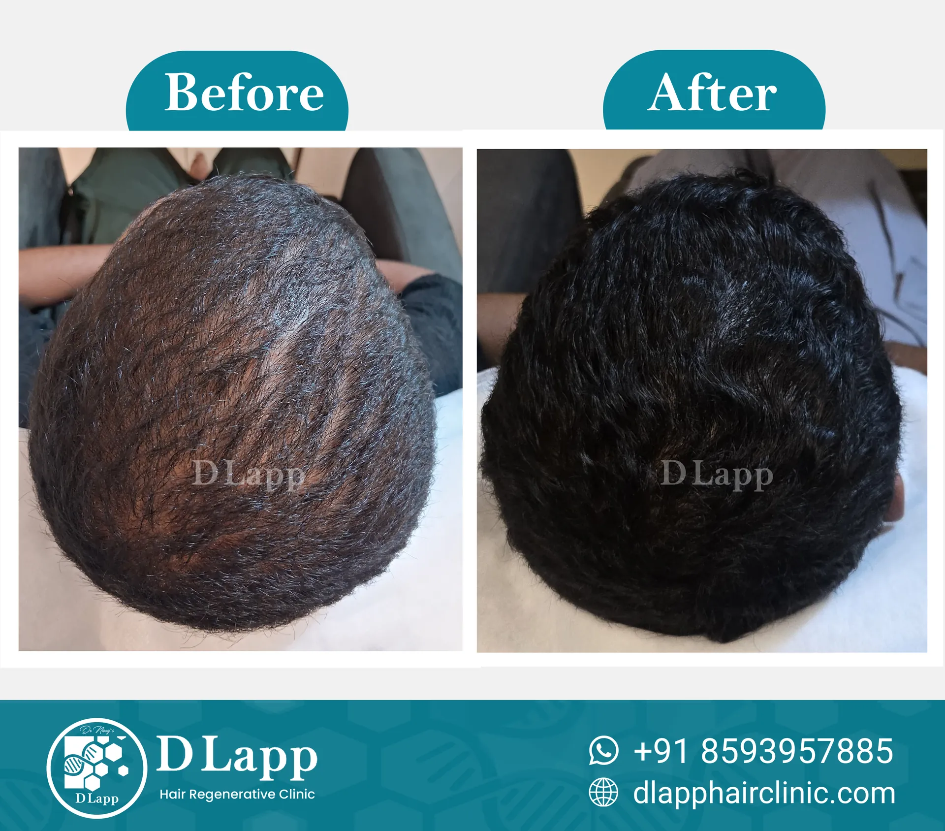 Before/After Medical Image