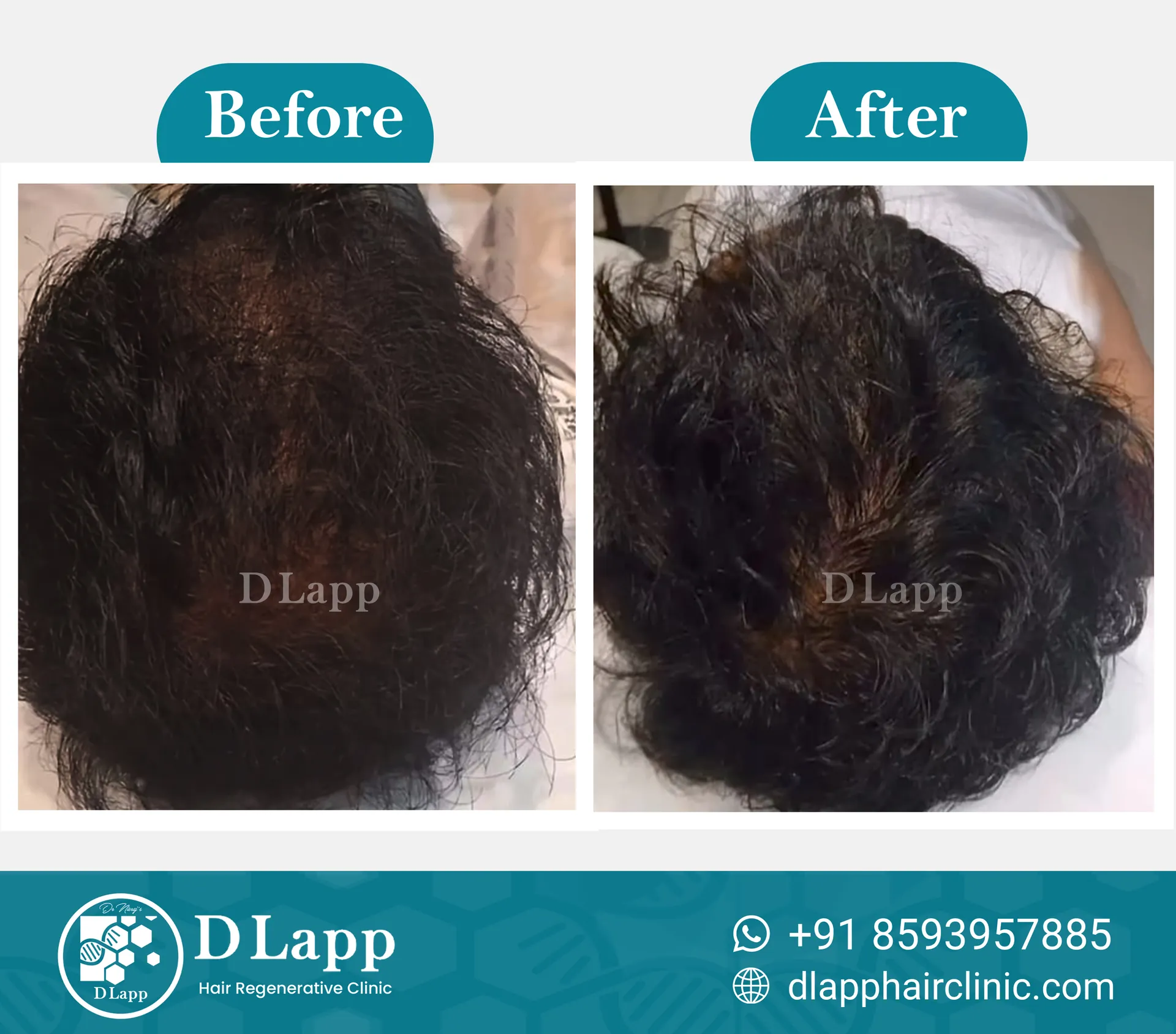 Before/After Medical Image