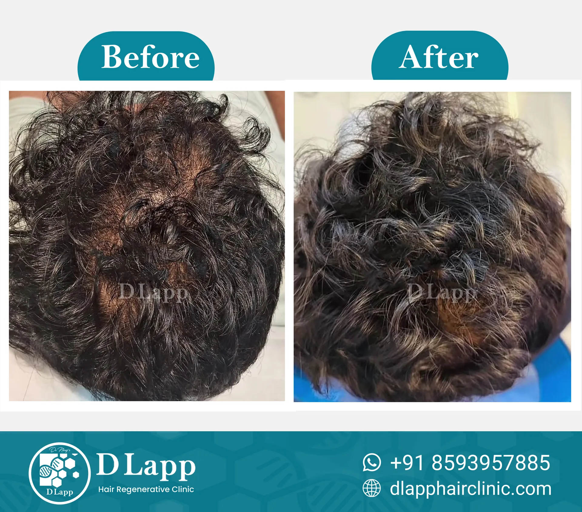 Before/After Medical Image
