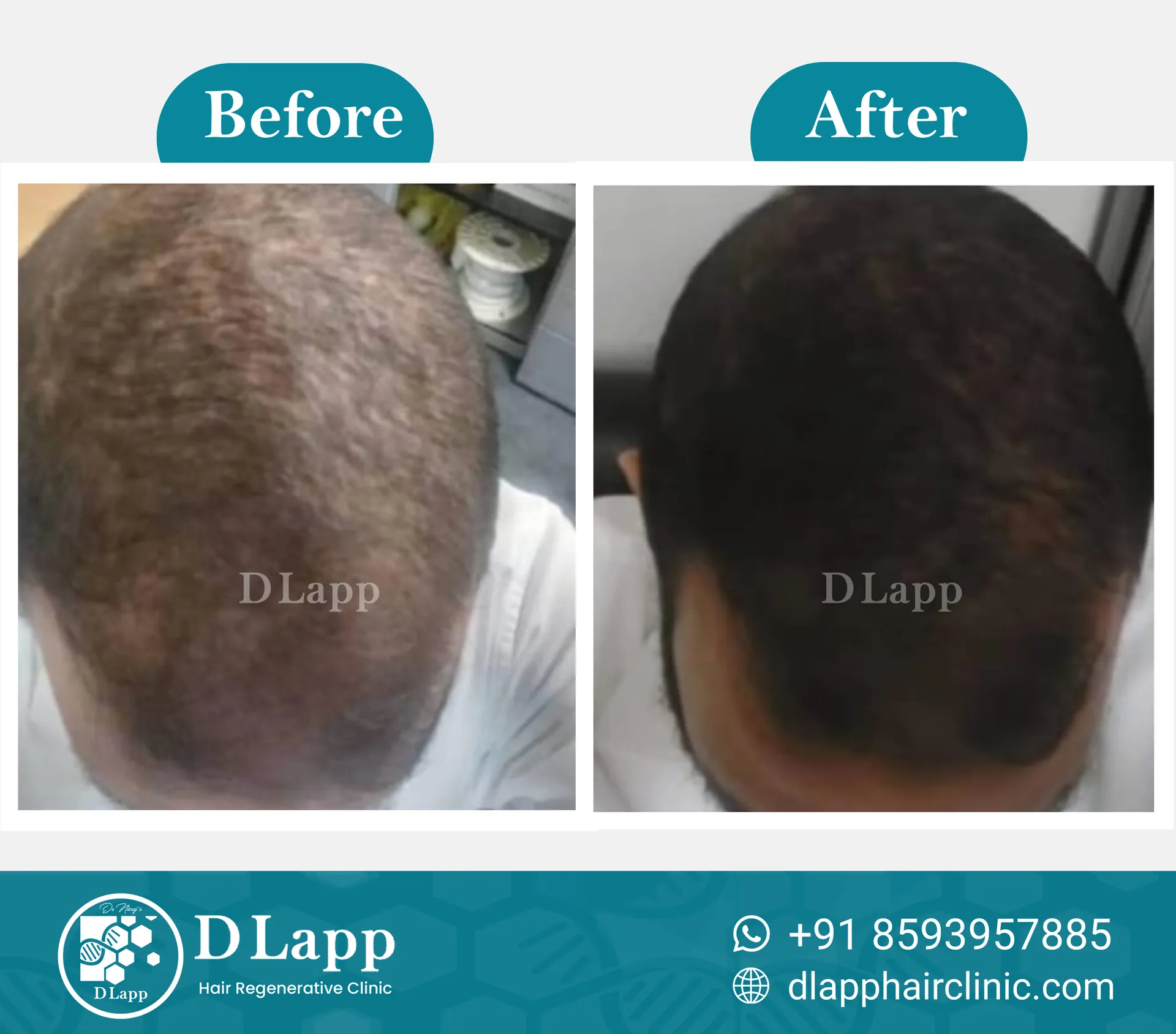 Before/After Medical Image