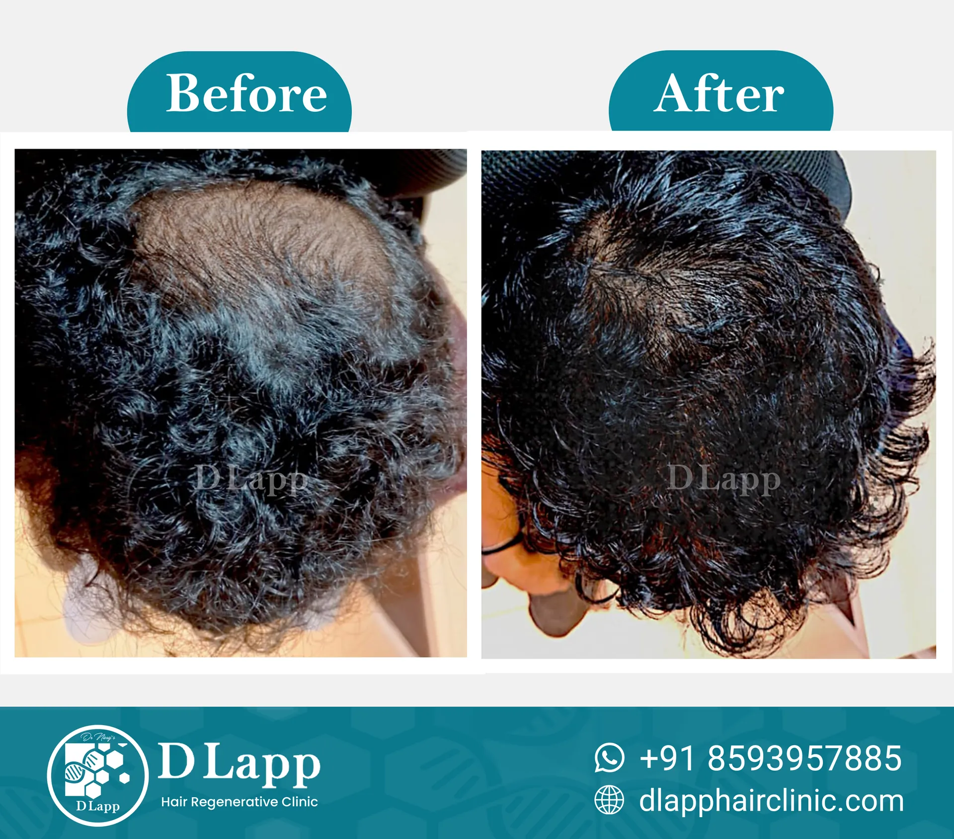 Before/After Medical Image