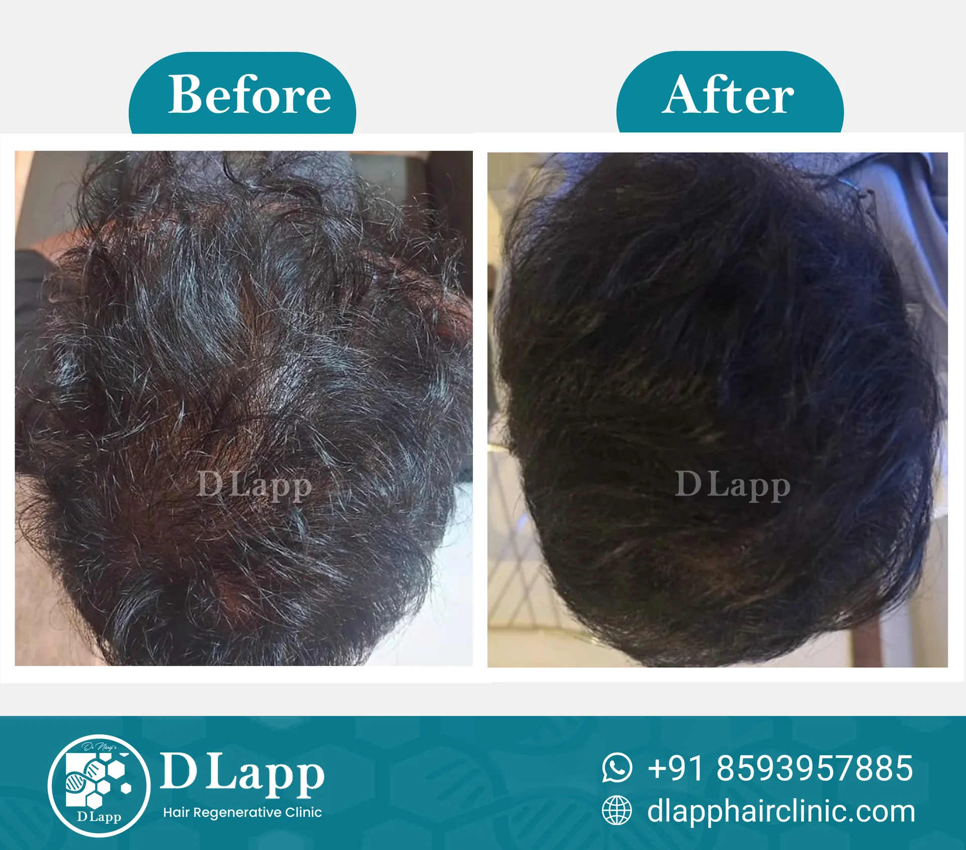 Before/After Medical Image