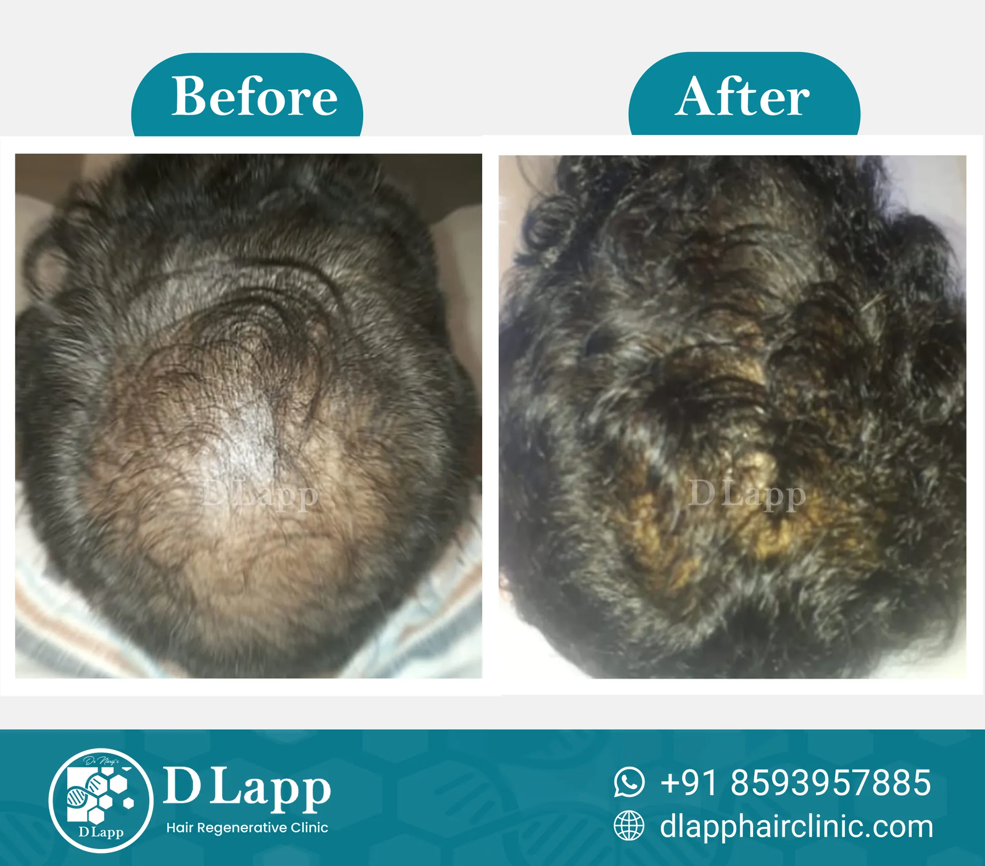Before/After Medical Image