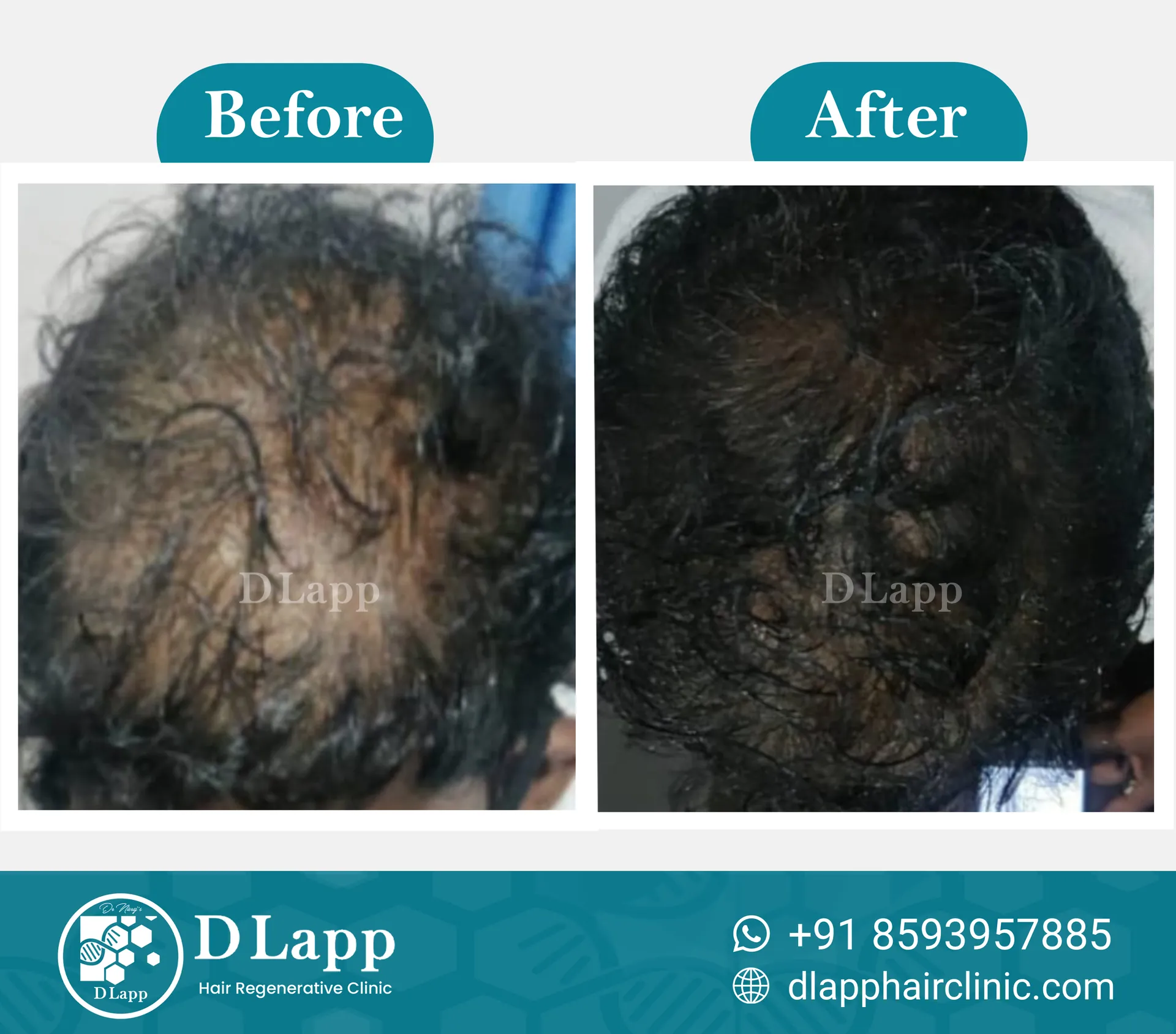 Before/After Medical Image
