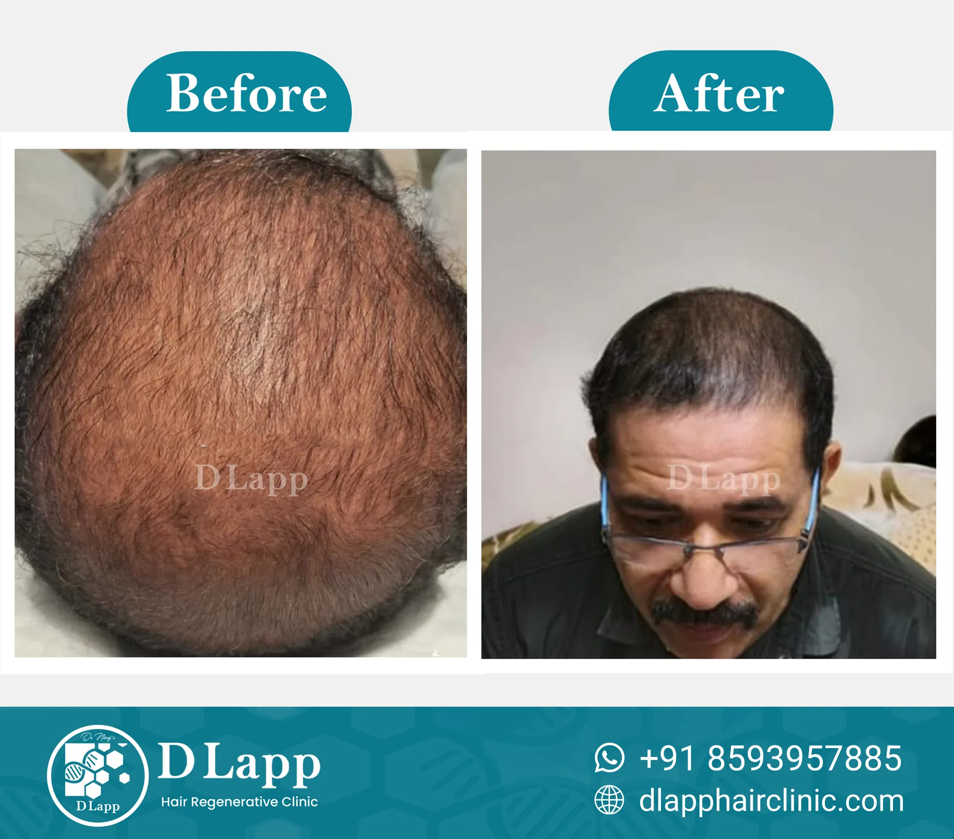 Before/After Medical Image