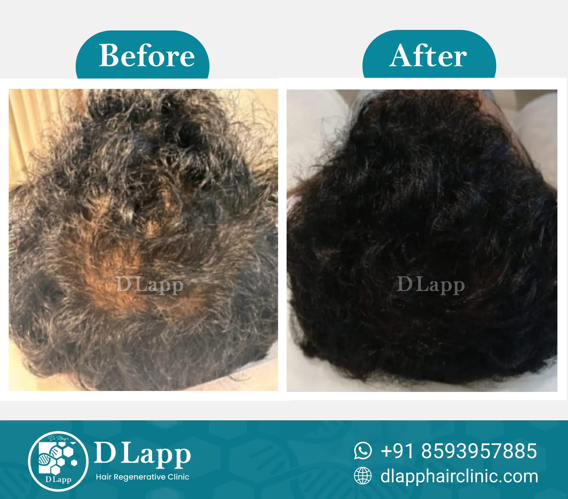 Before/After Medical Image