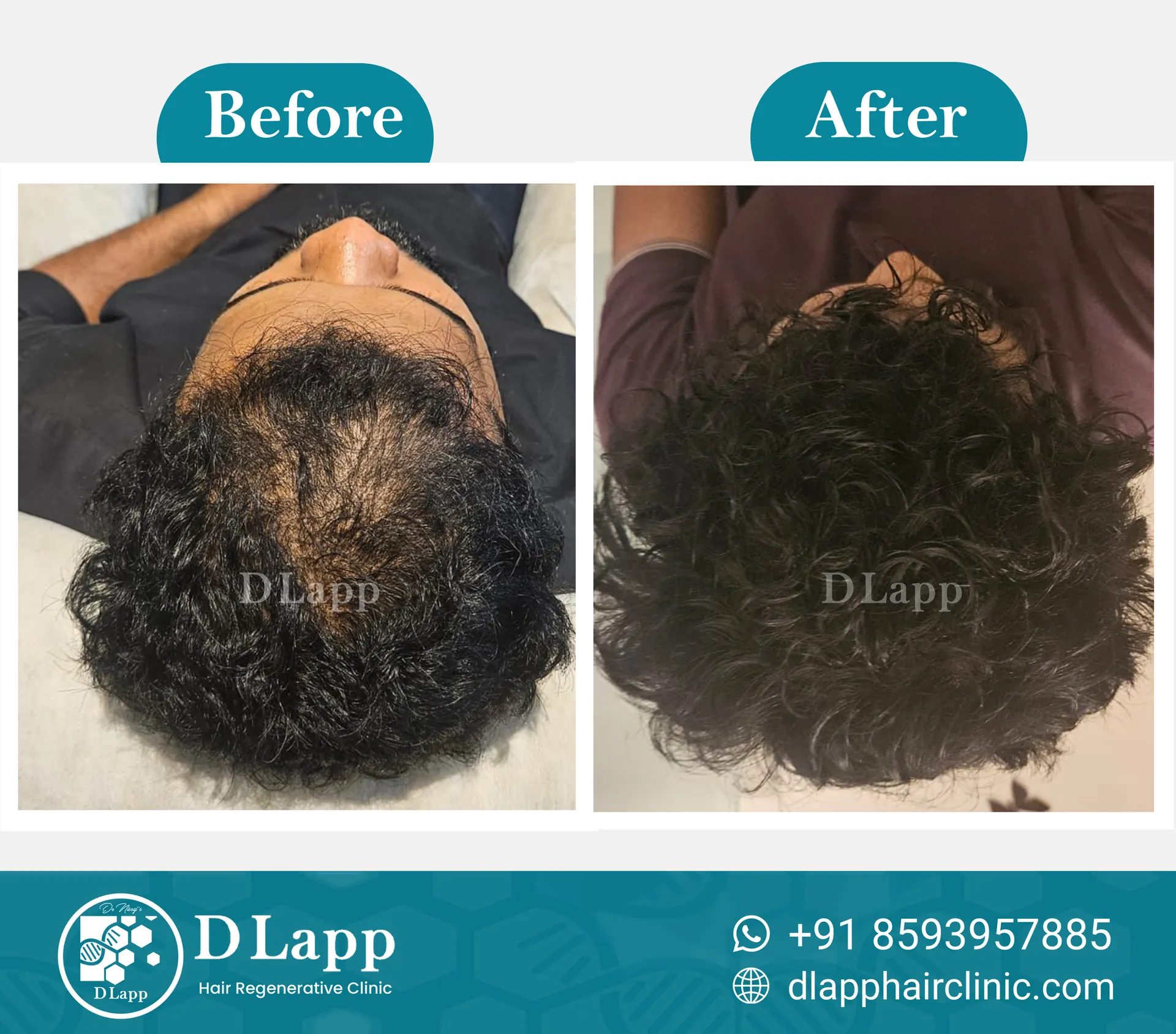 Before/After Medical Image
