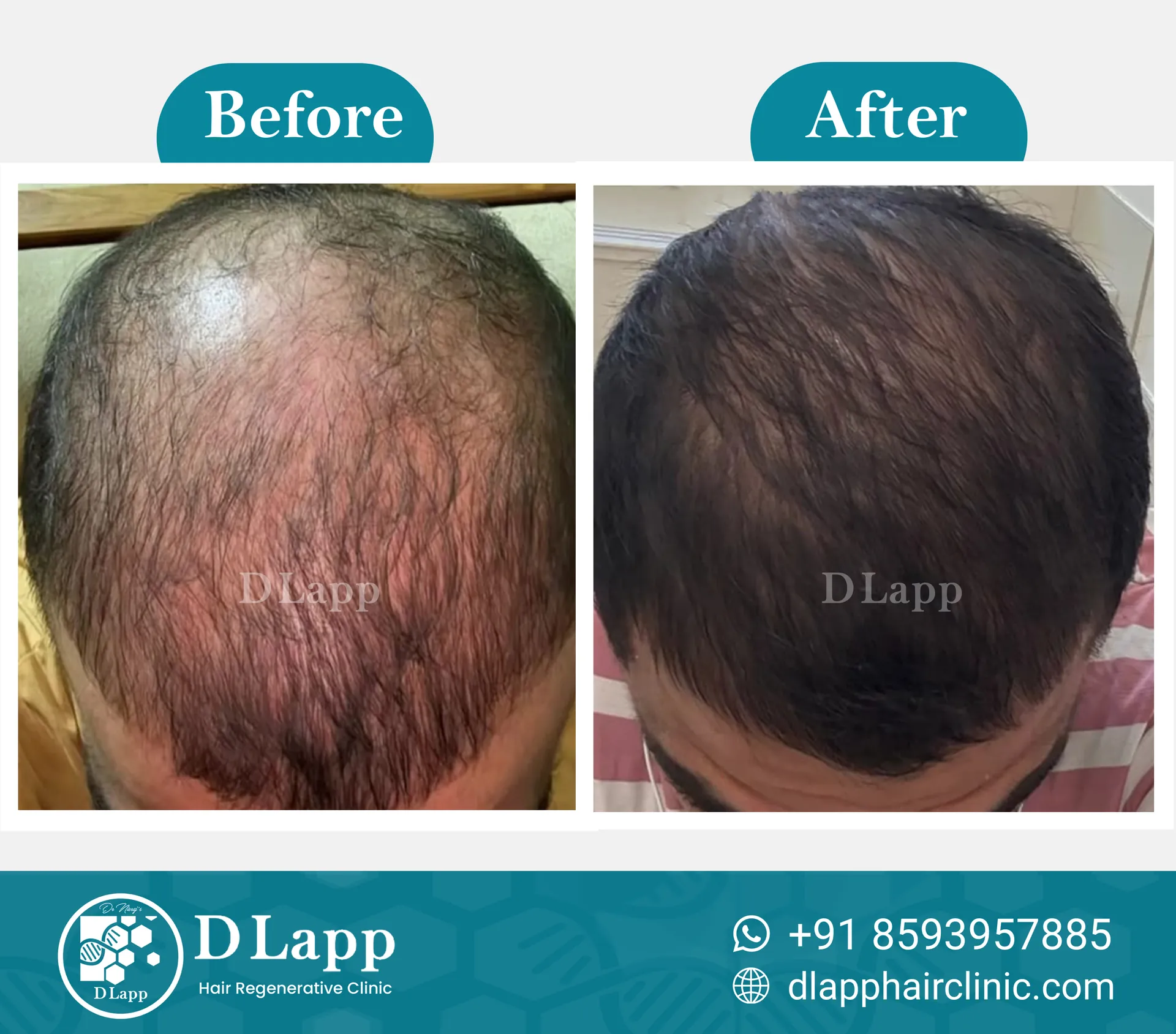 Before/After Medical Image
