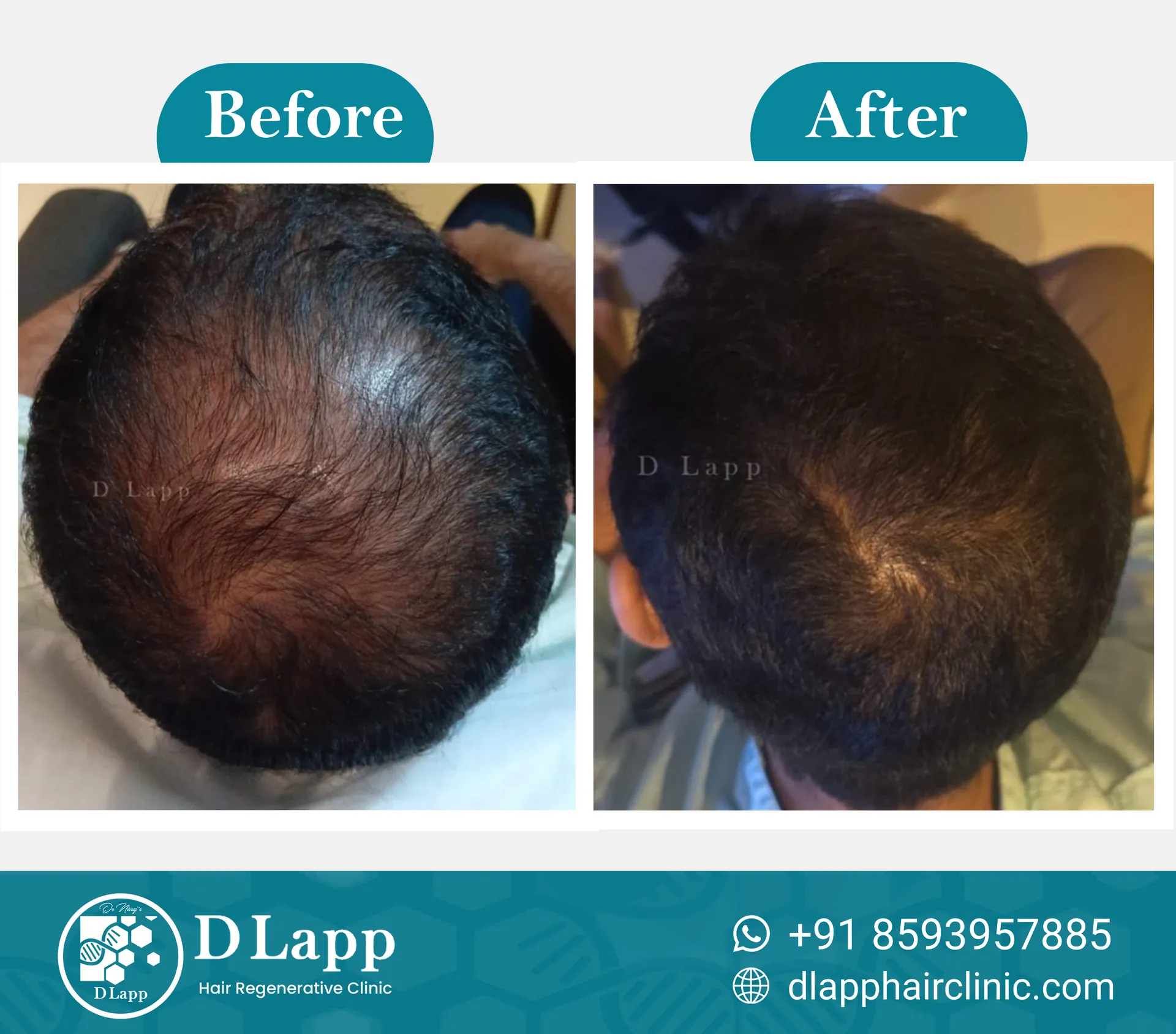 Before/After Medical Image