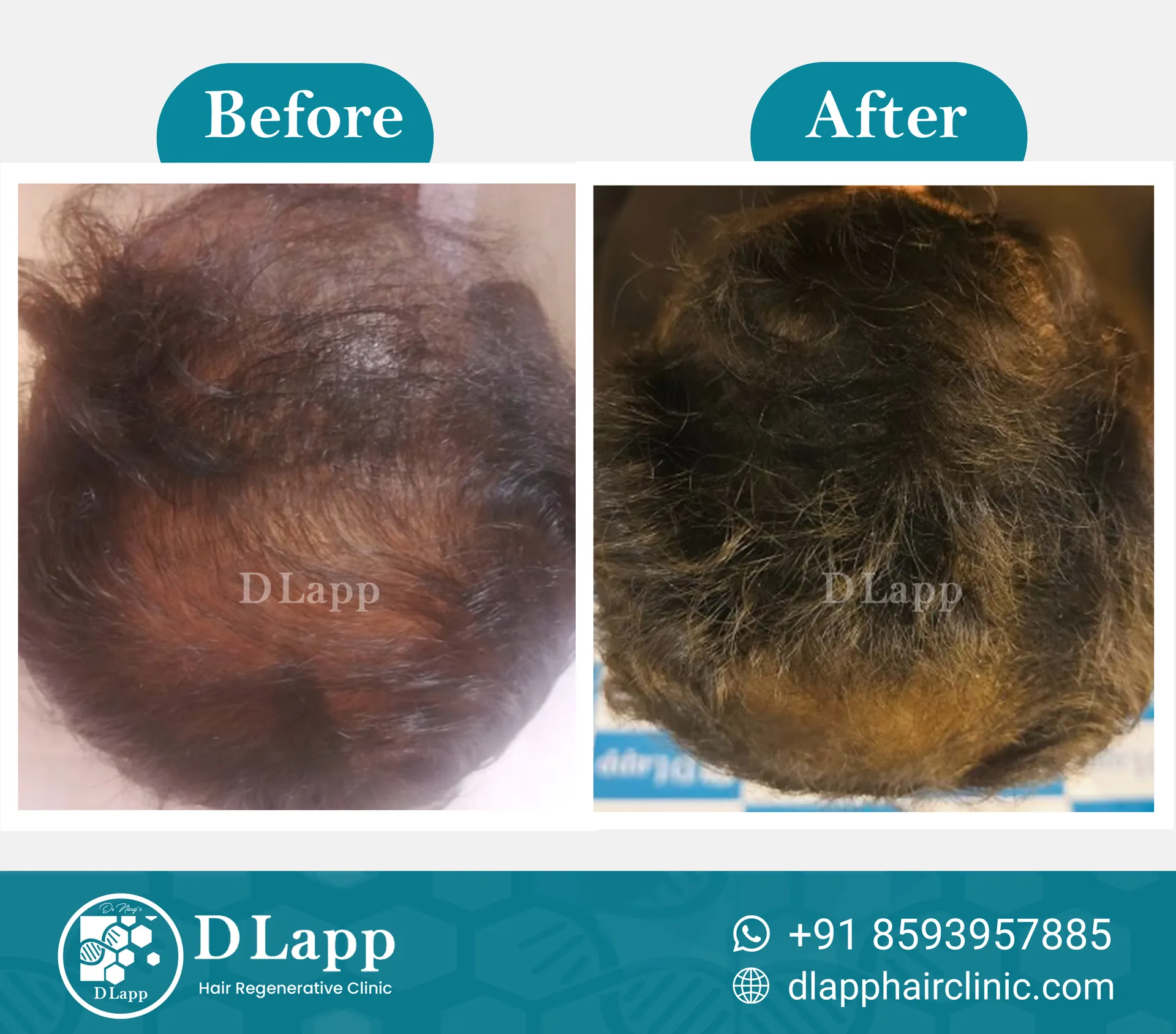 Before/After Medical Image
