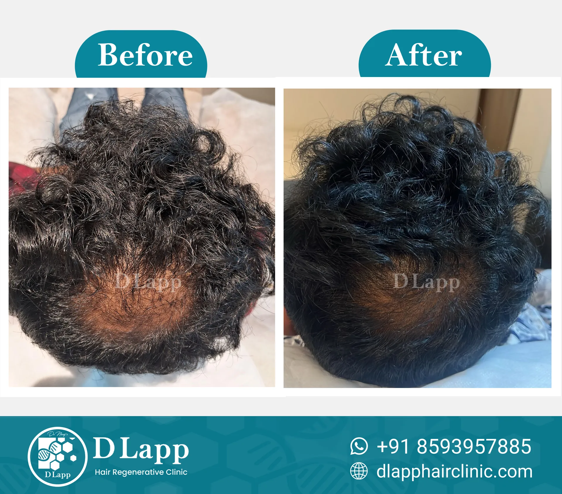 Before/After Medical Image