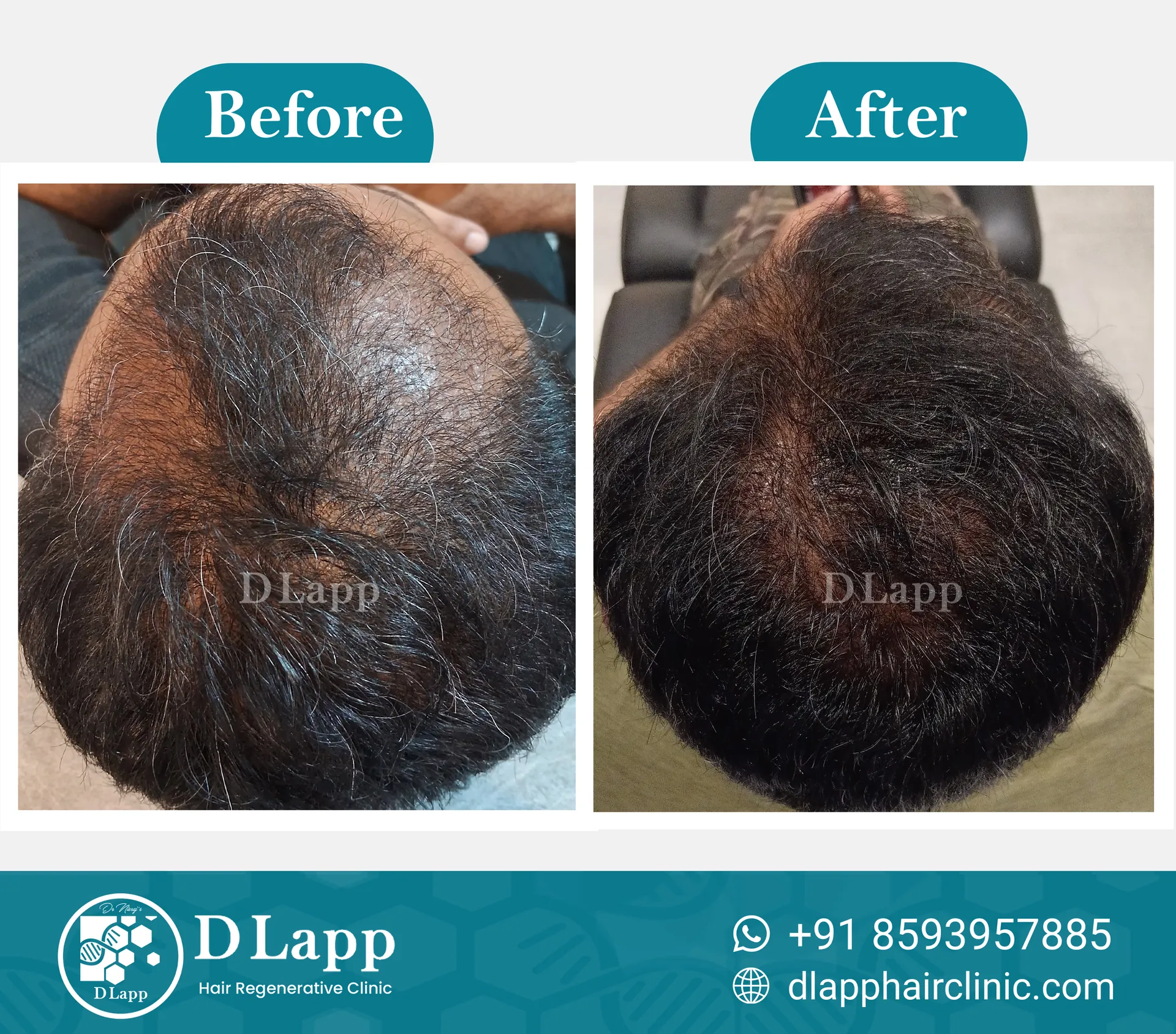 Before/After Medical Image