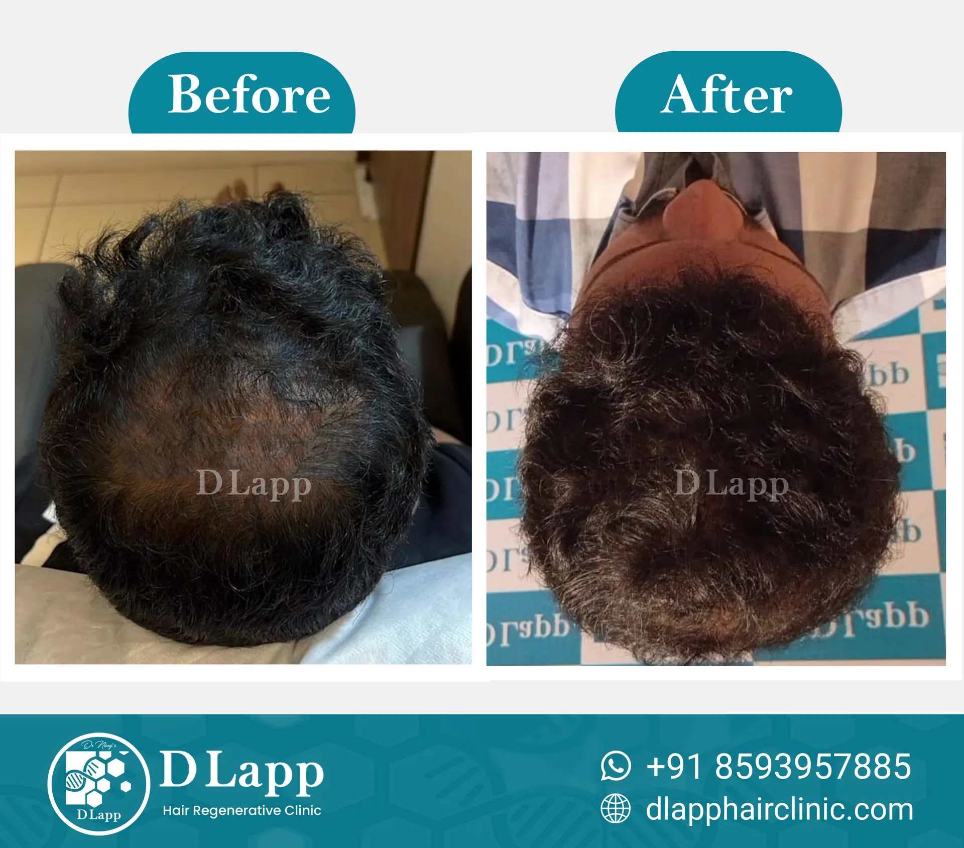 Before/After Medical Image