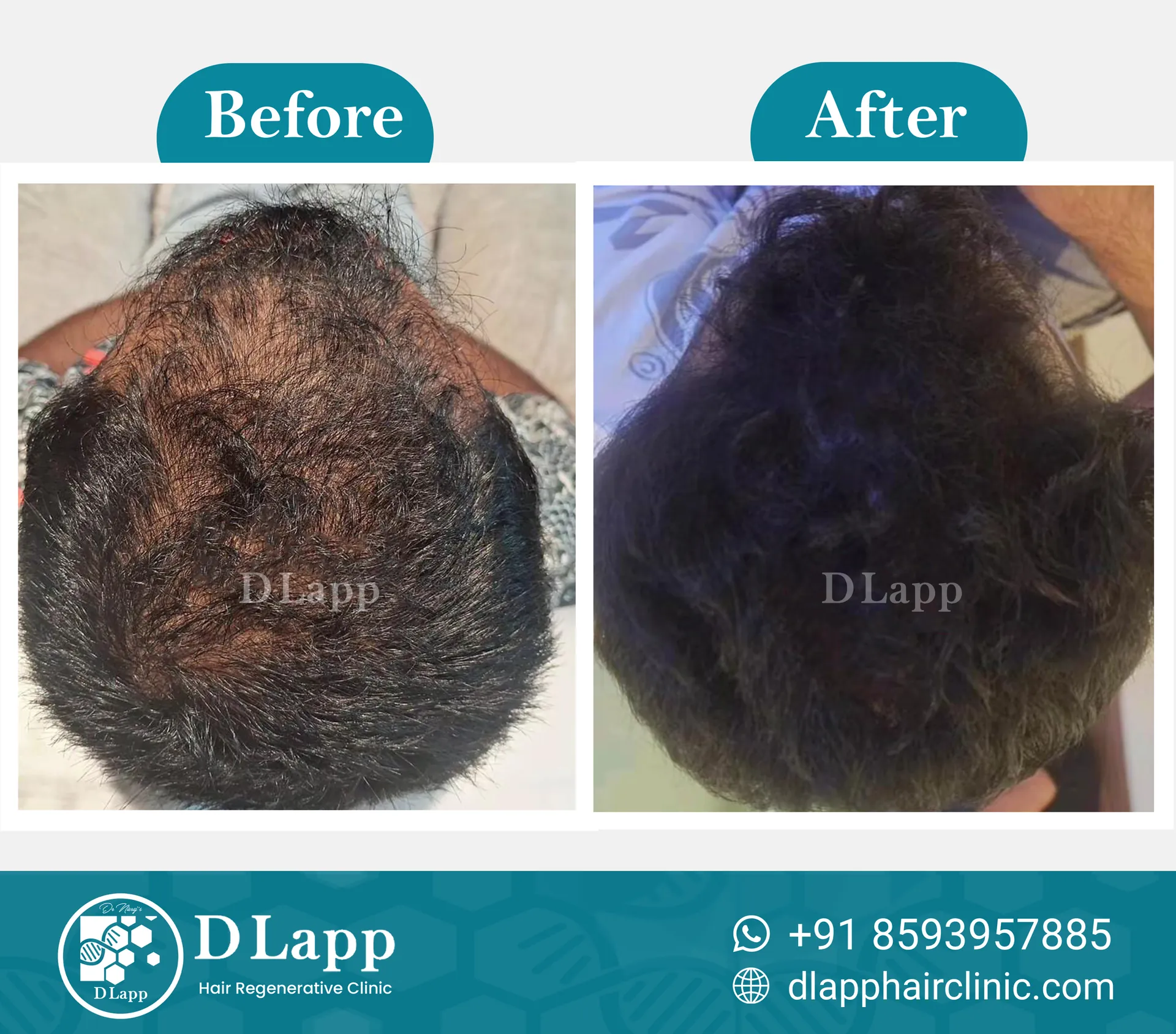Before/After Medical Image