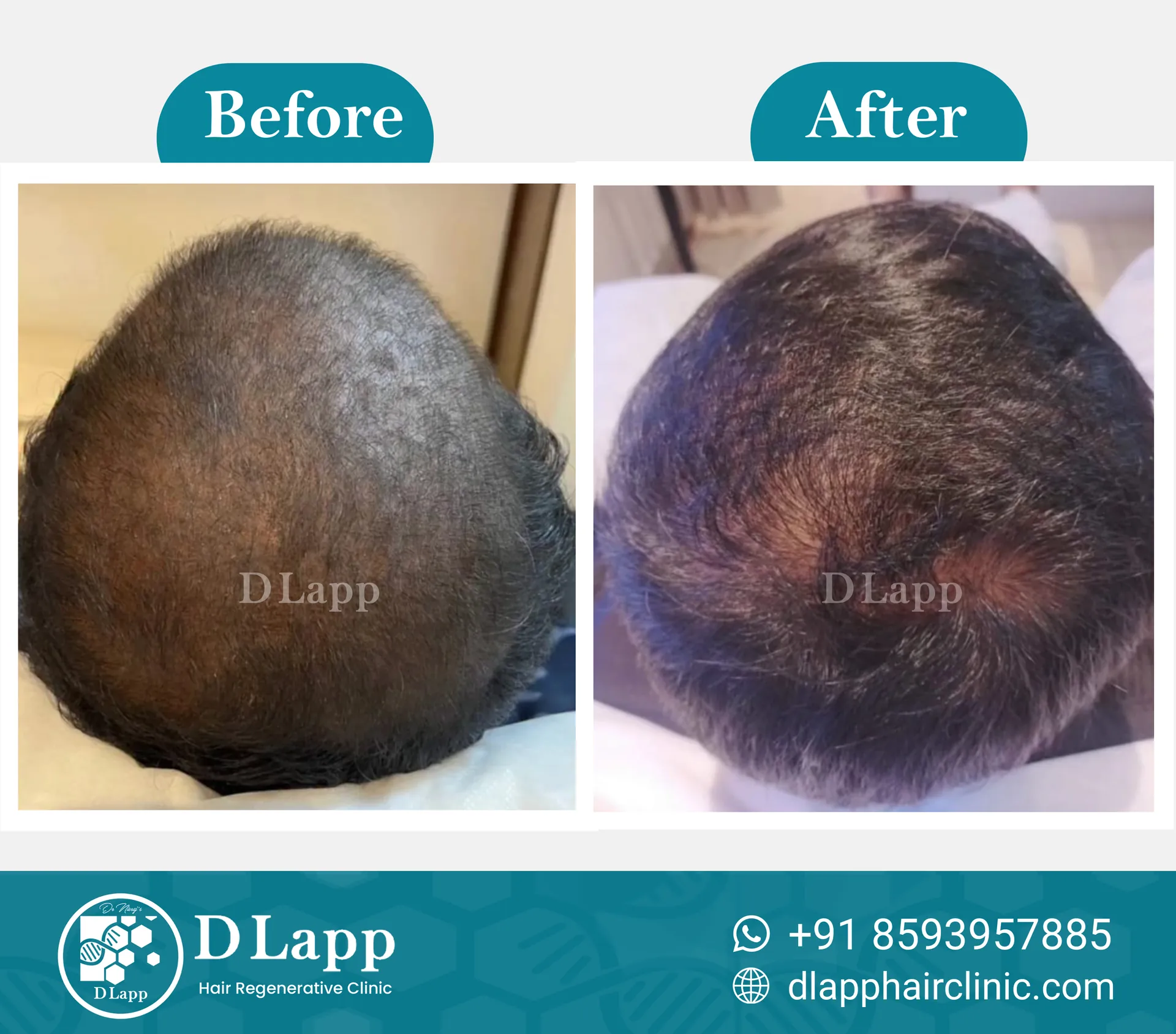 Before/After Medical Image