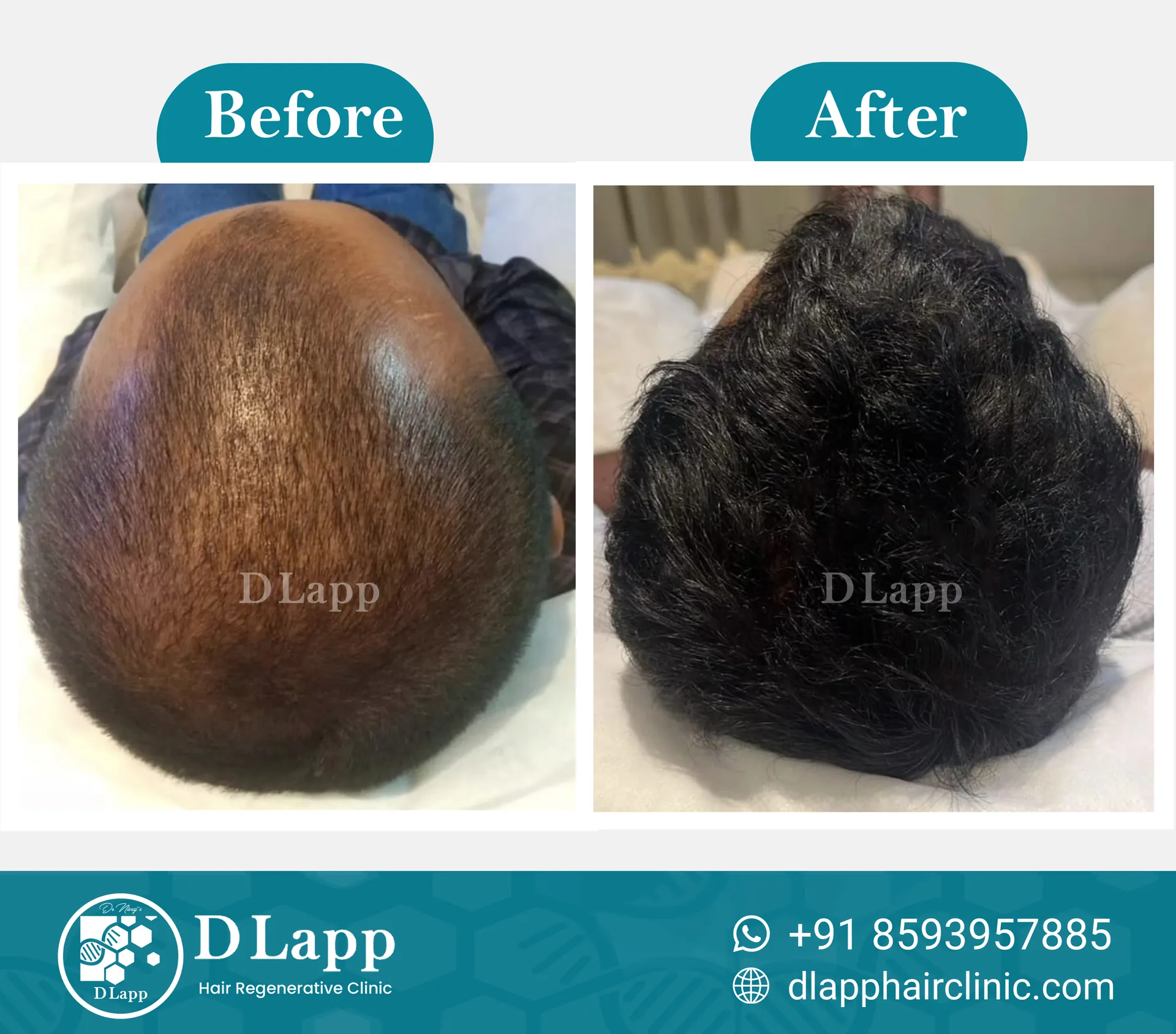 Before/After Medical Image