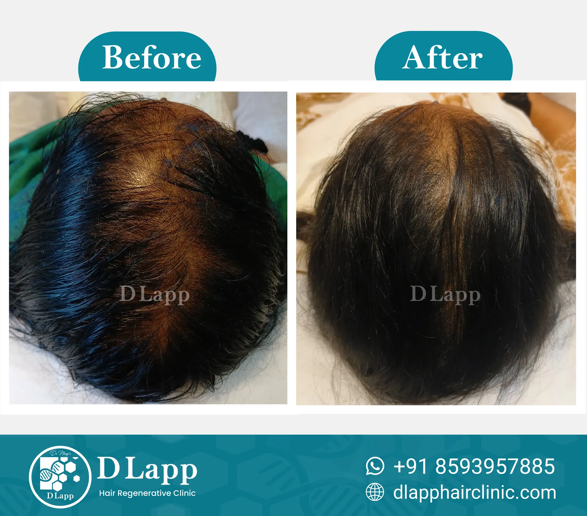Before/After Medical Image