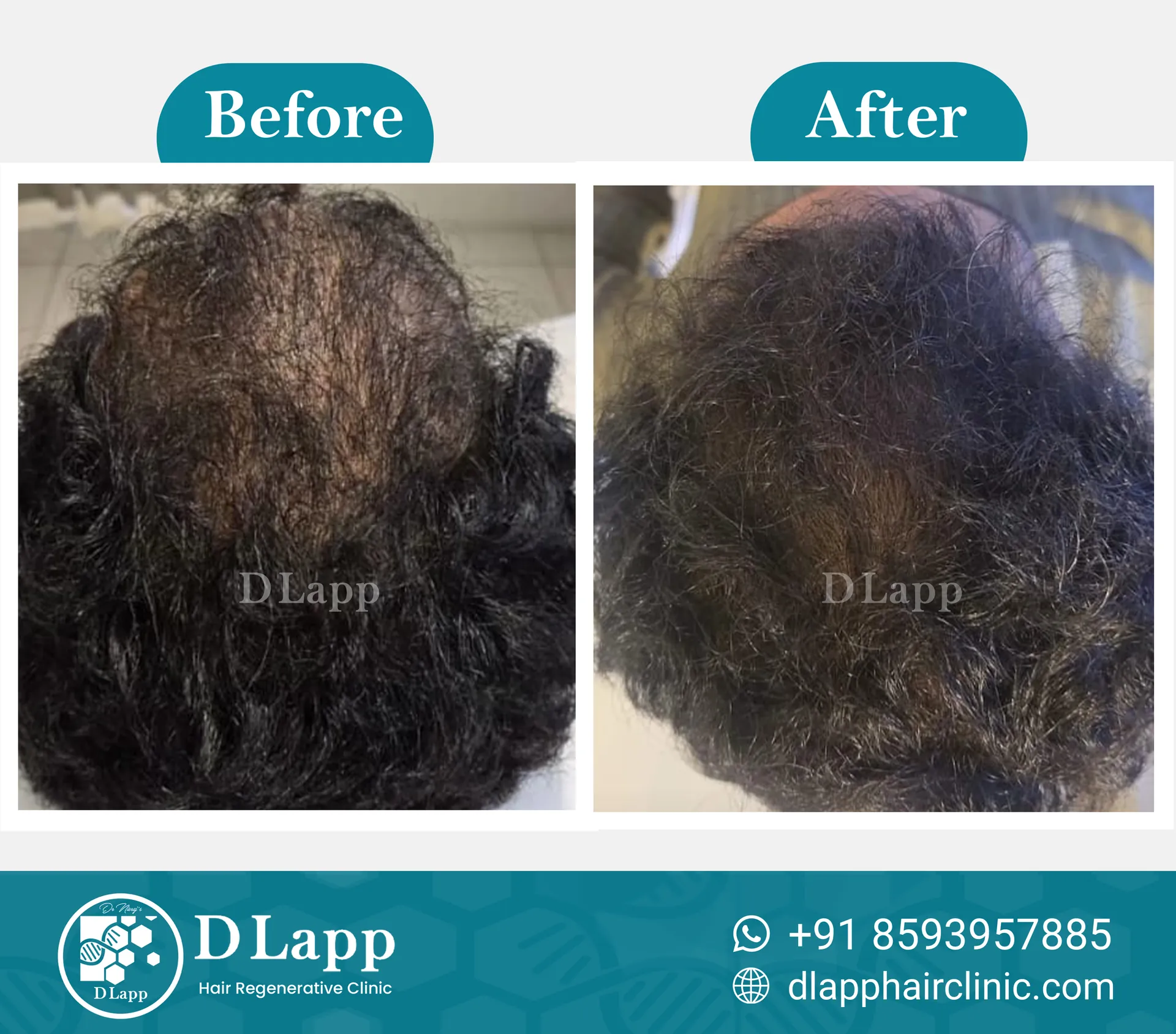 Before/After Medical Image