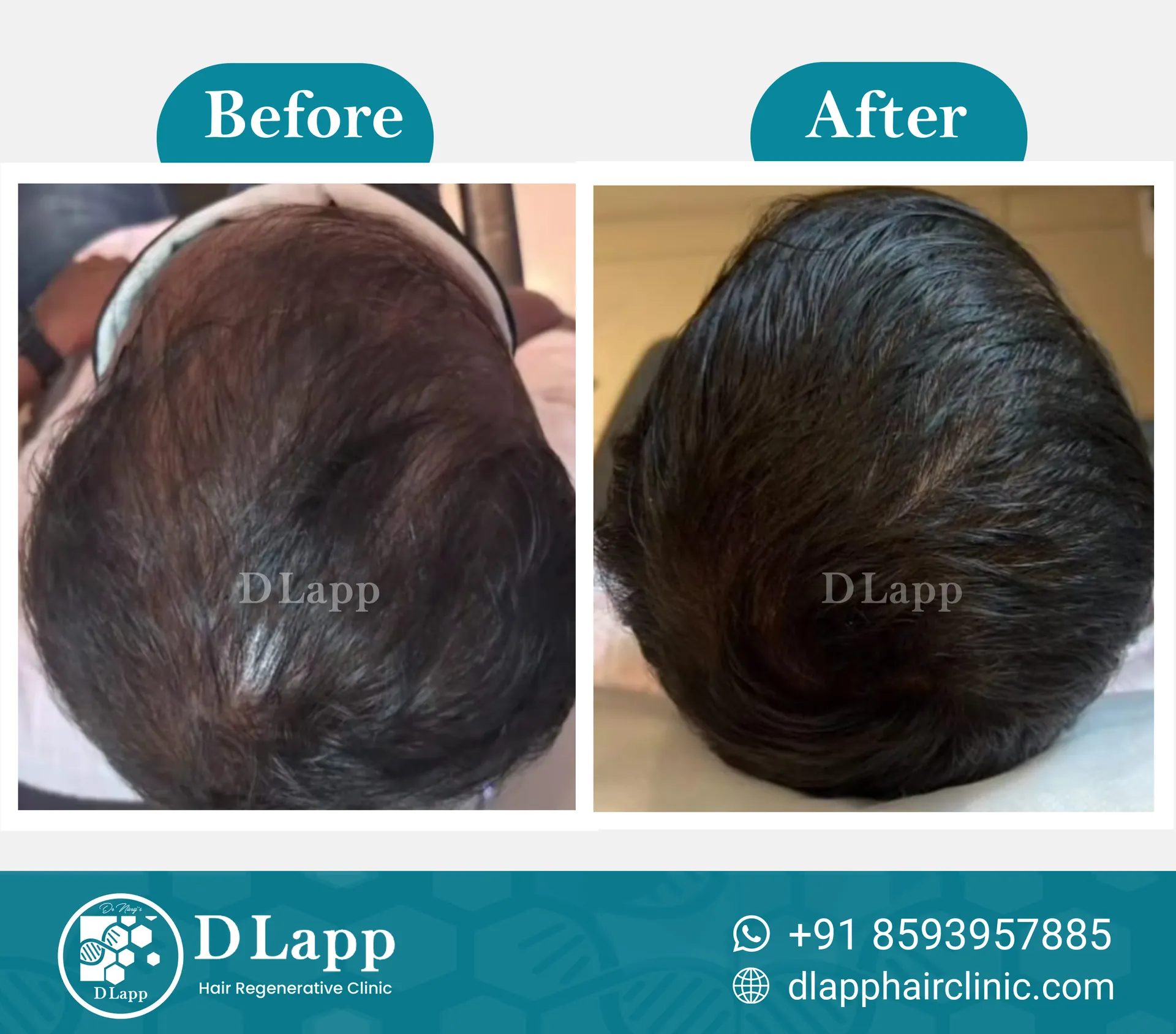 Before/After Medical Image