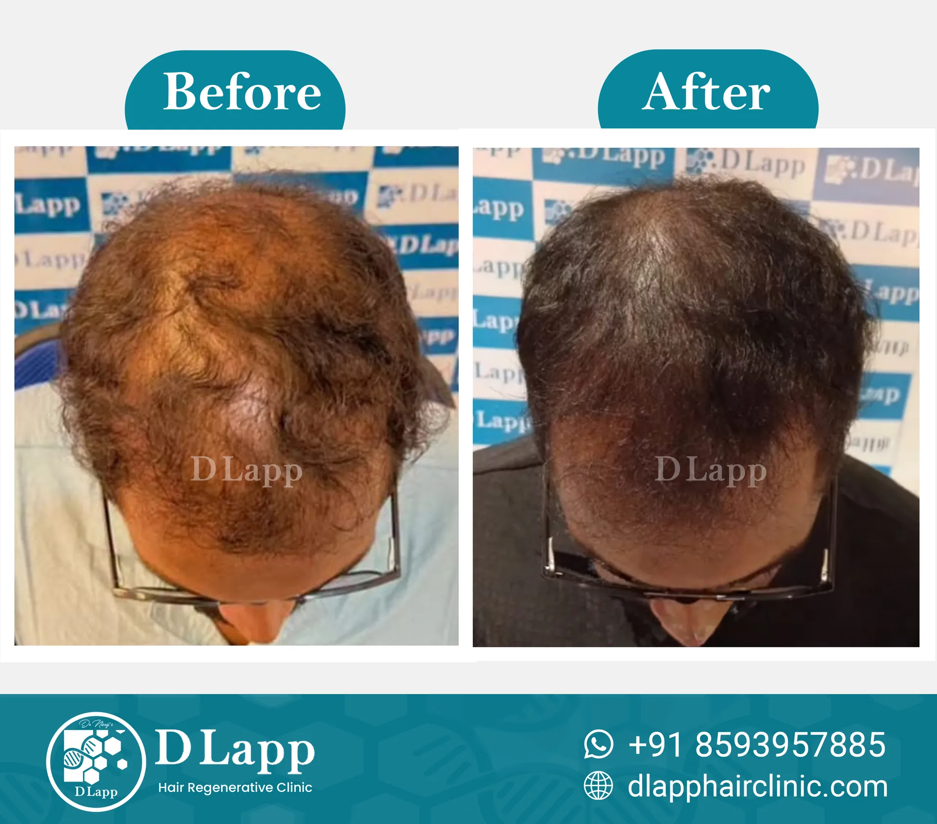 Before/After Medical Image