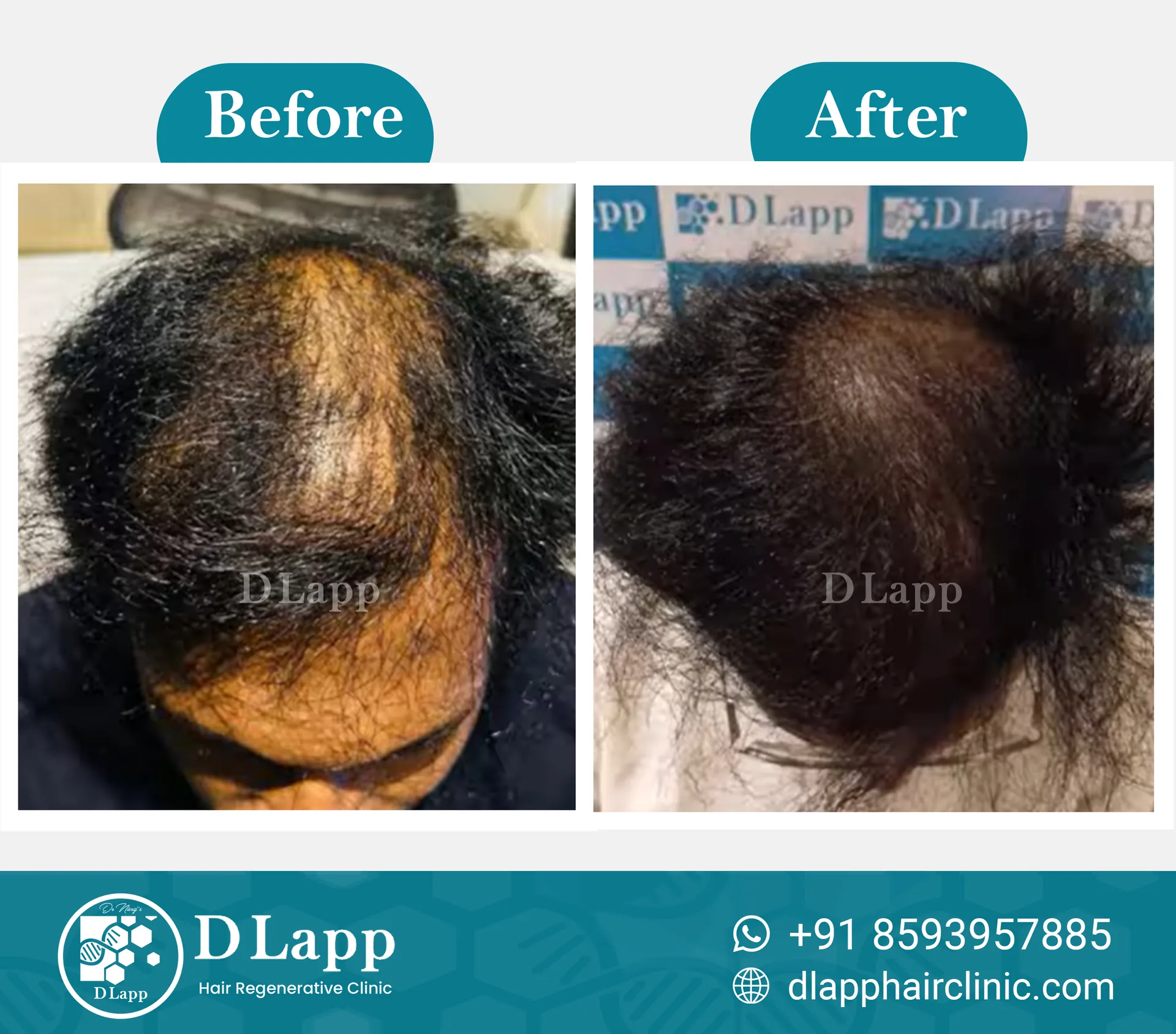 Before/After Medical Image