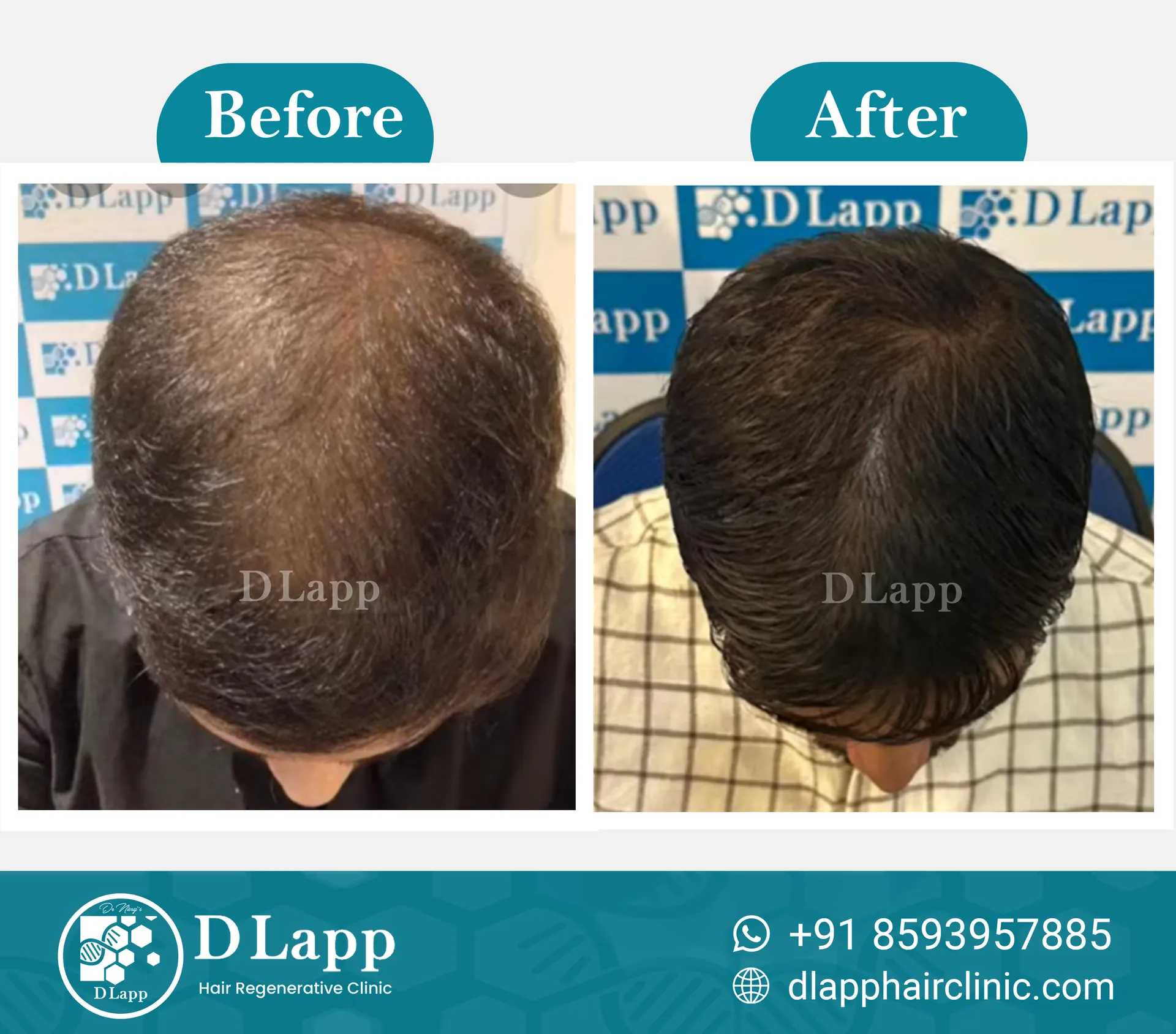 Before/After Medical Image