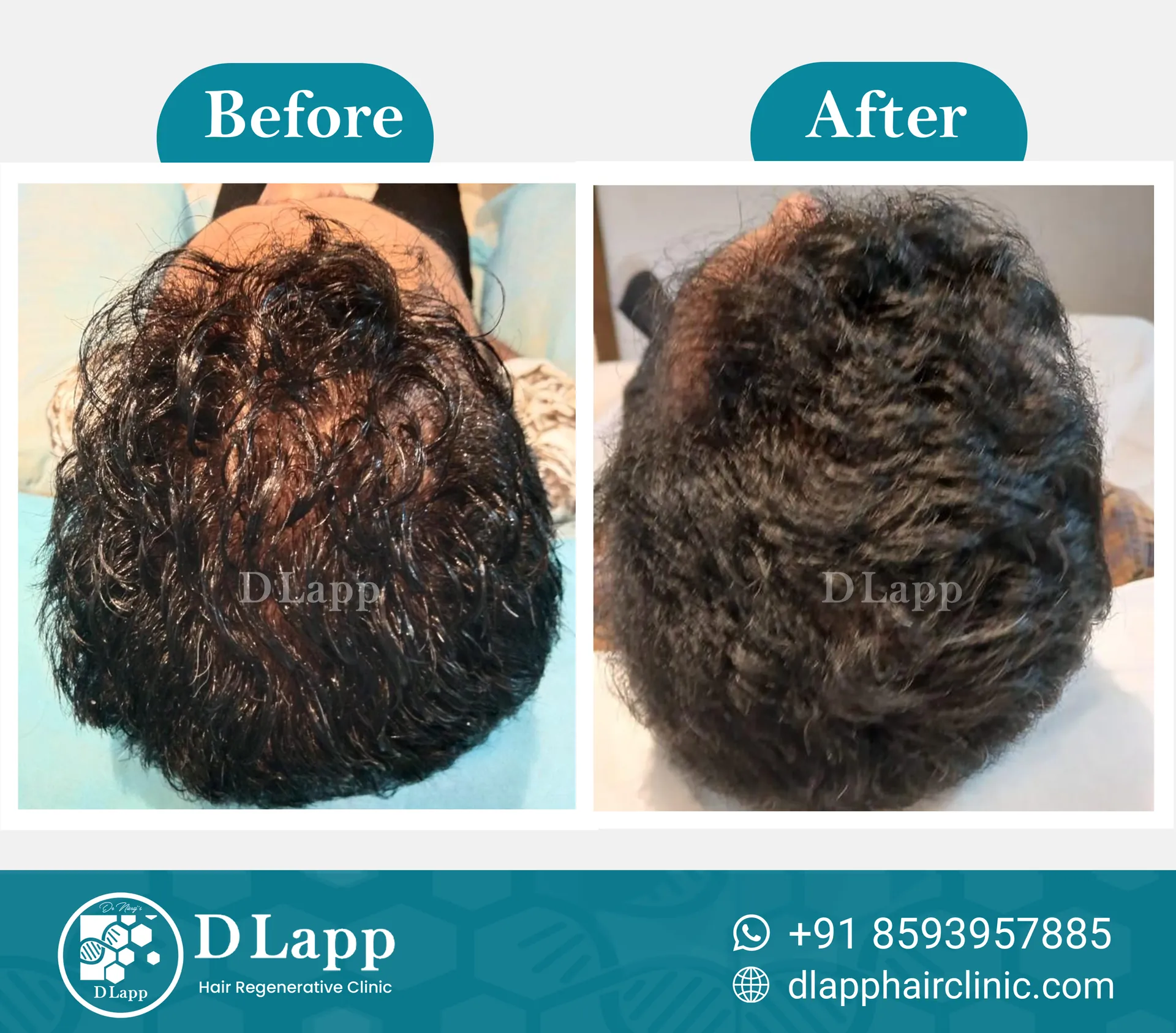 Before/After Medical Image