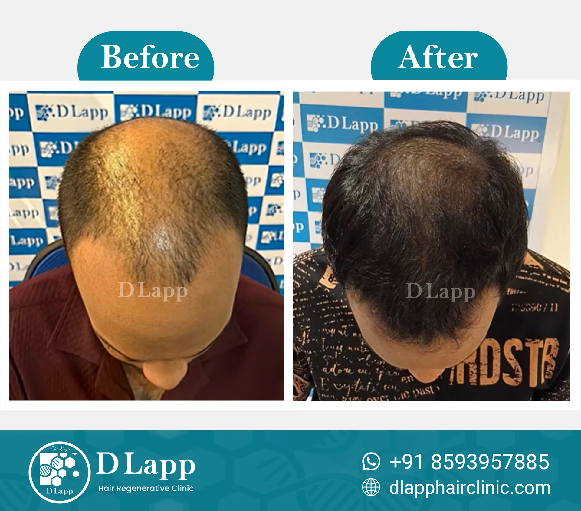 Before/After Medical Image