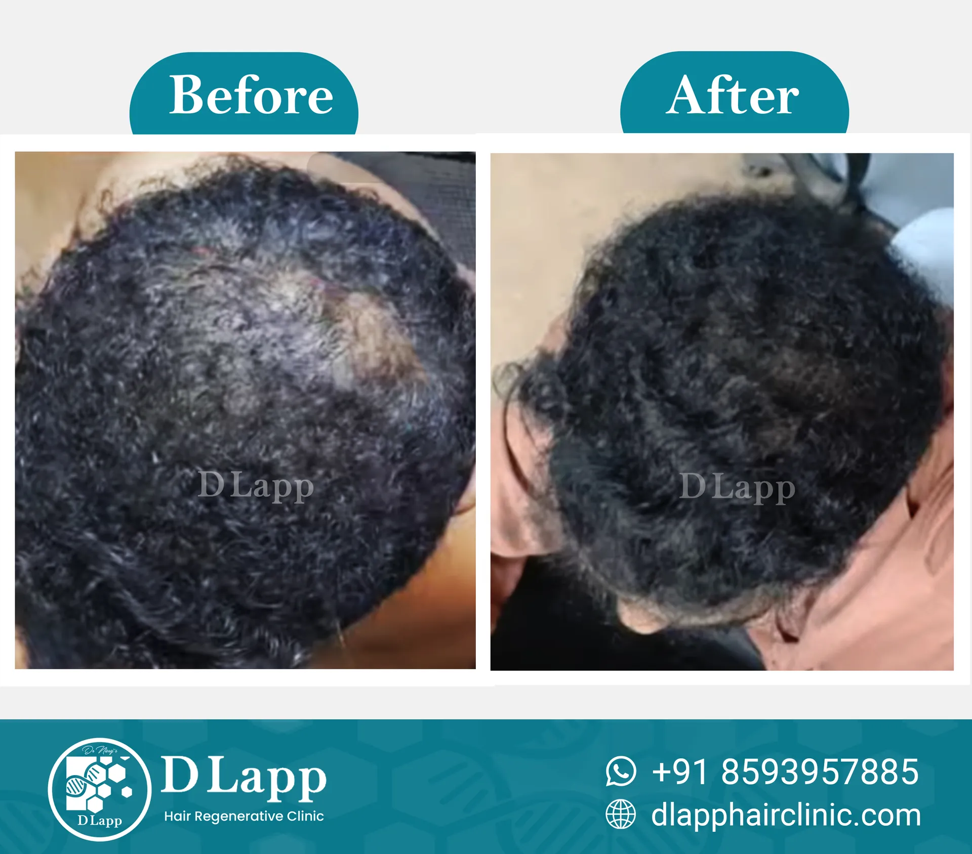 Before/After Medical Image