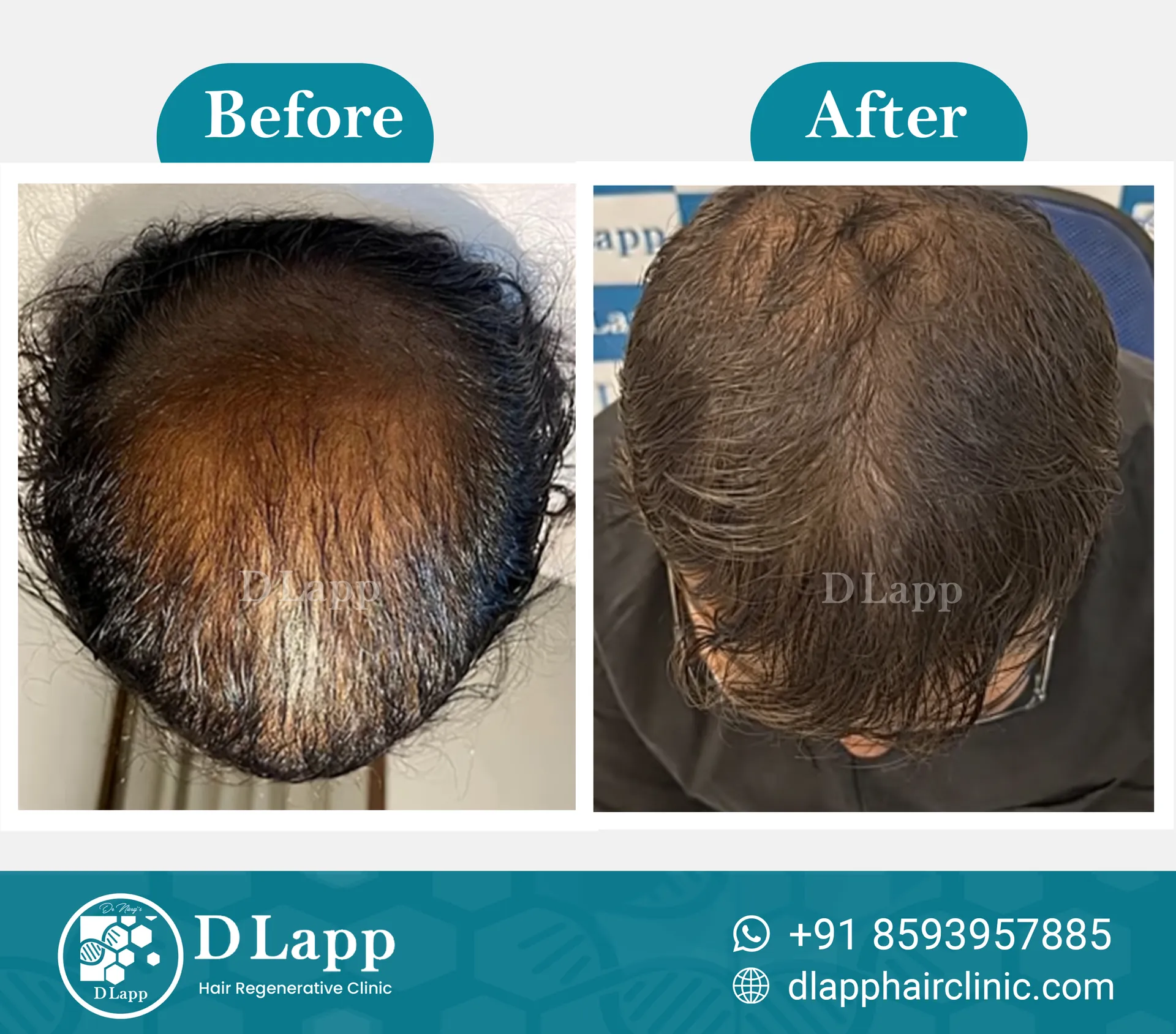 Before/After Medical Image