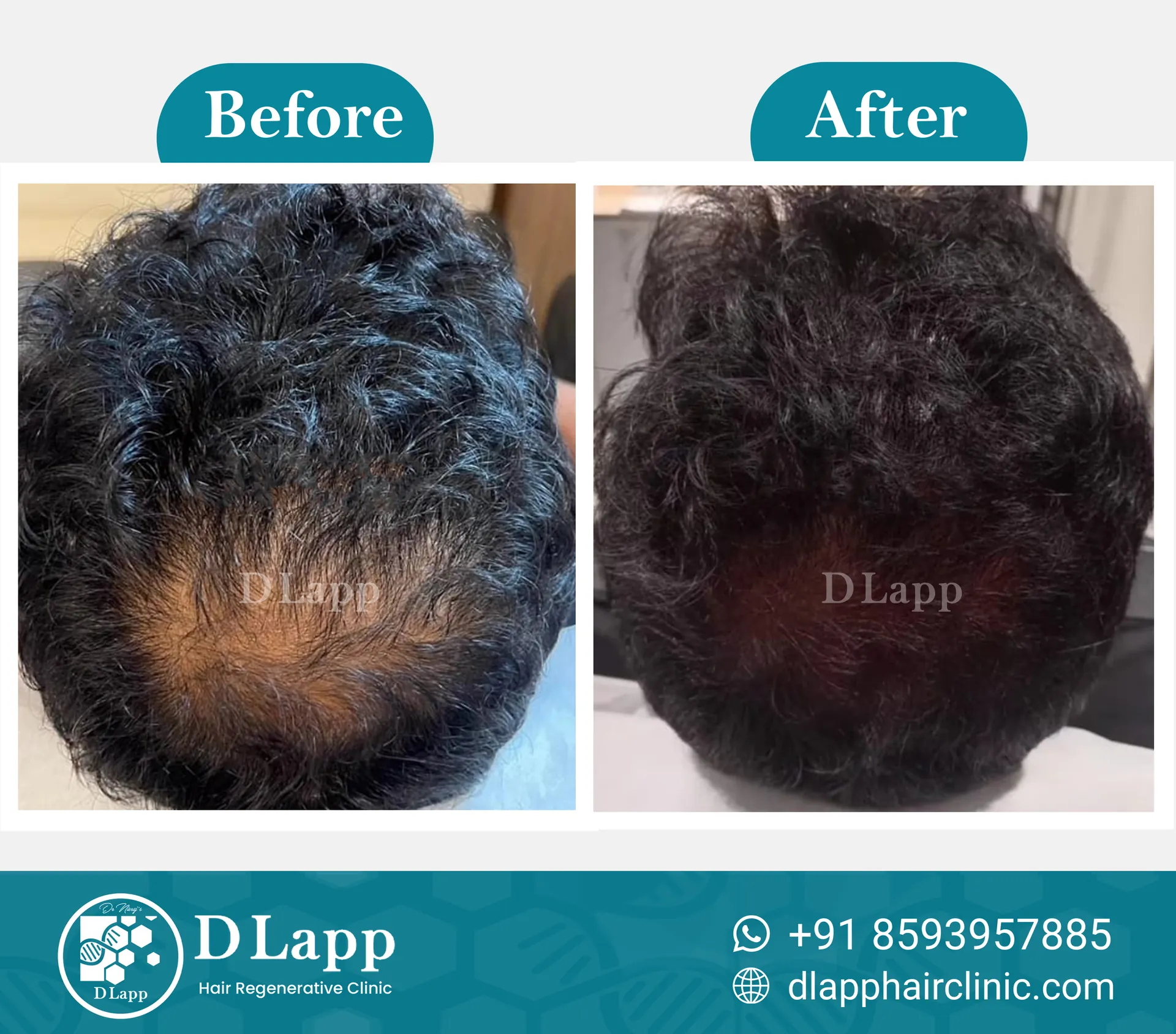 Before/After Medical Image