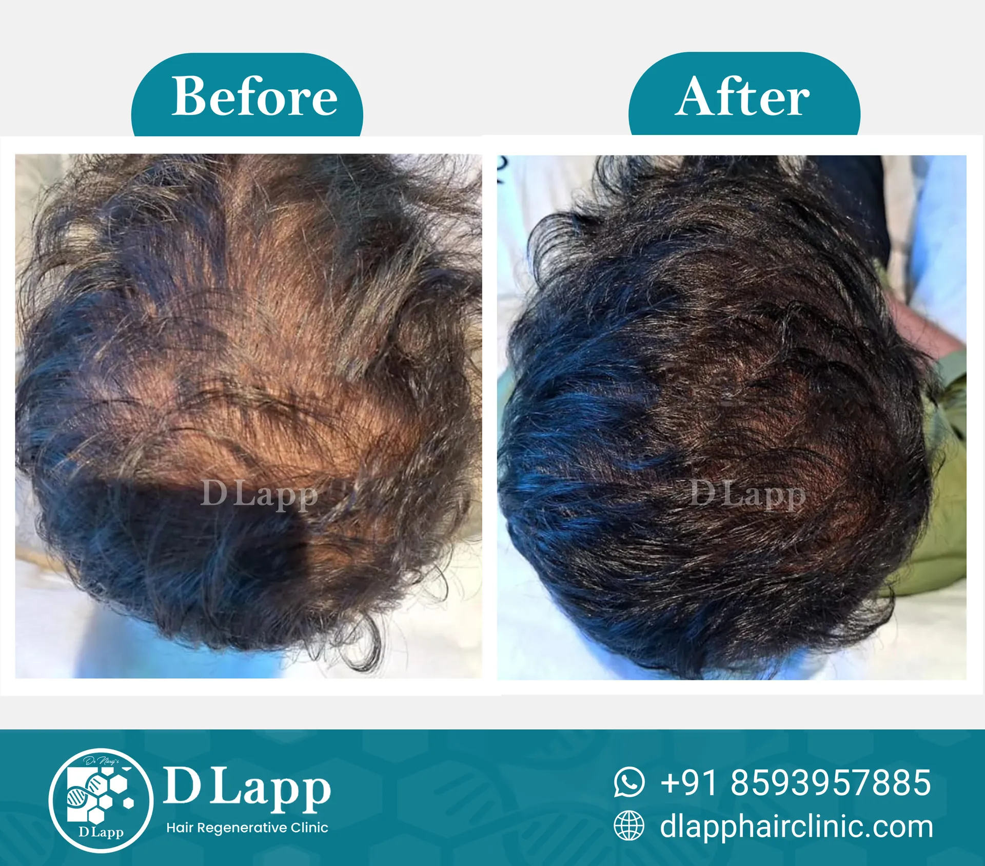 Before/After Medical Image