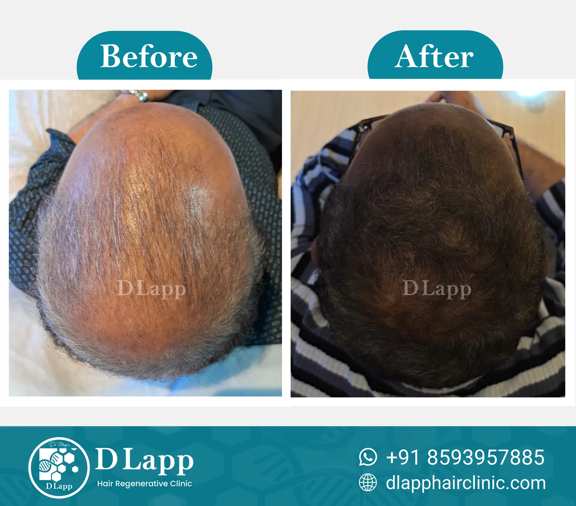 Before/After Medical Image