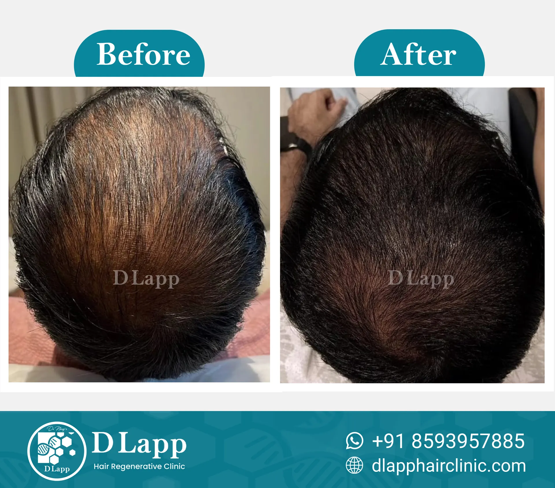 Before/After Medical Image