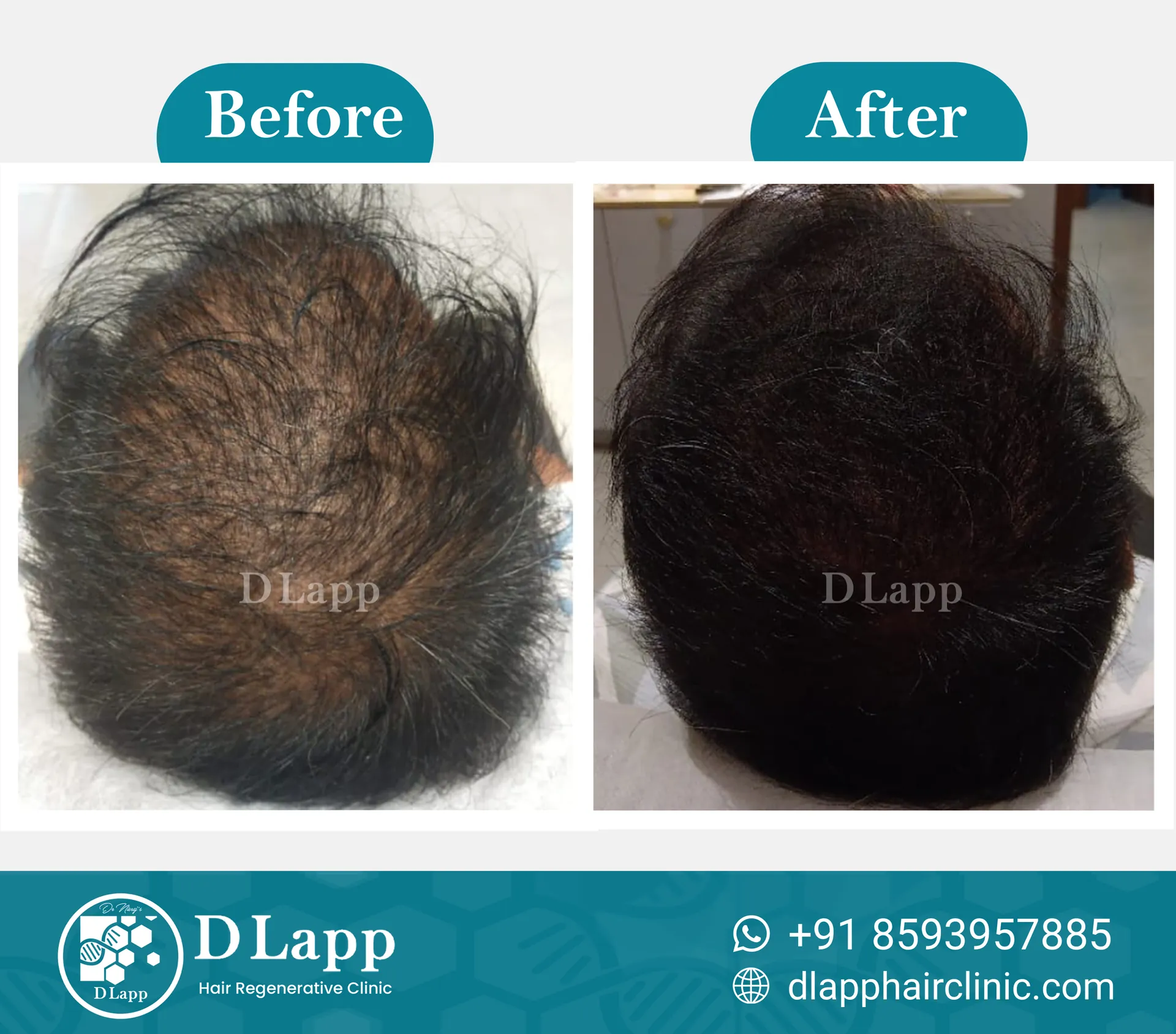 Before/After Medical Image