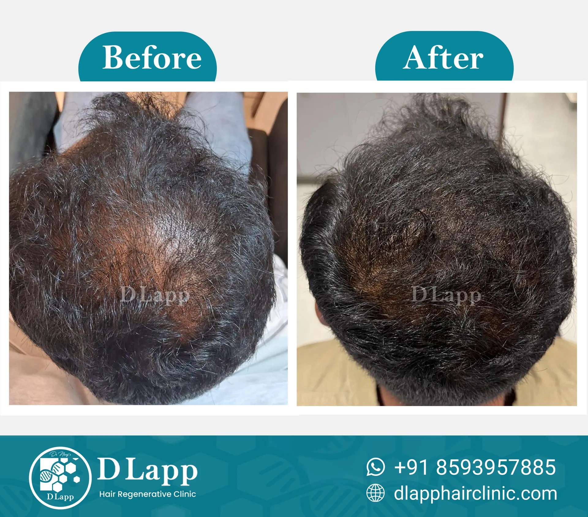 Before/After Medical Image