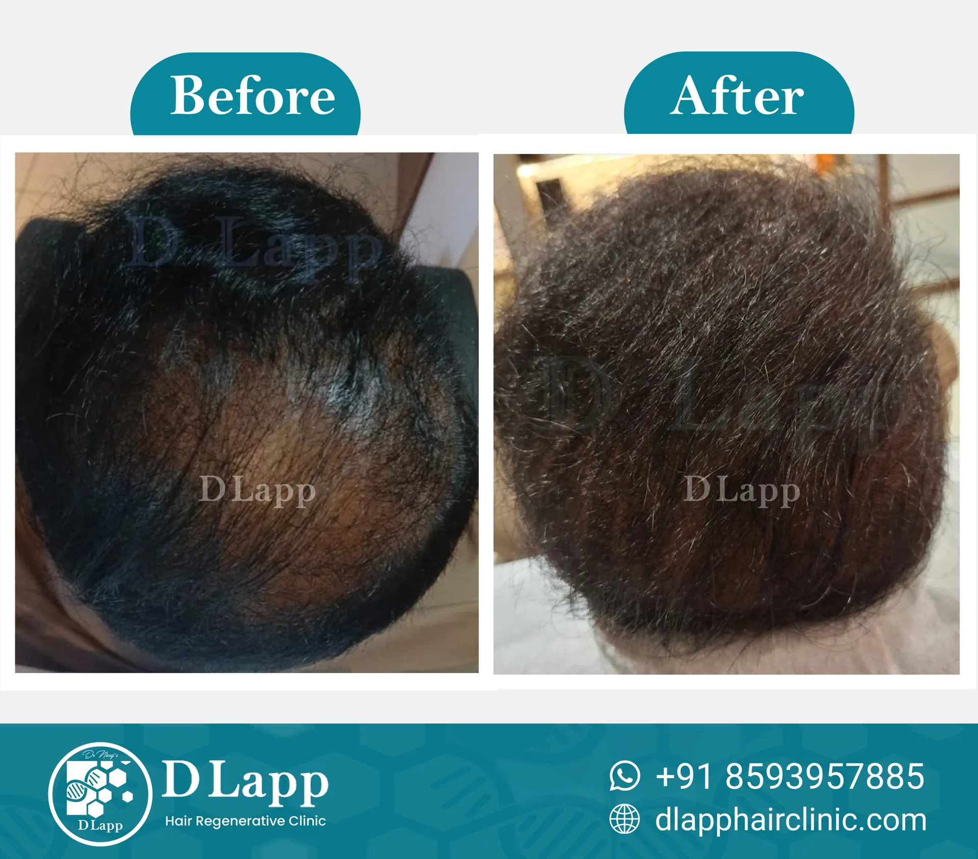Before/After Medical Image