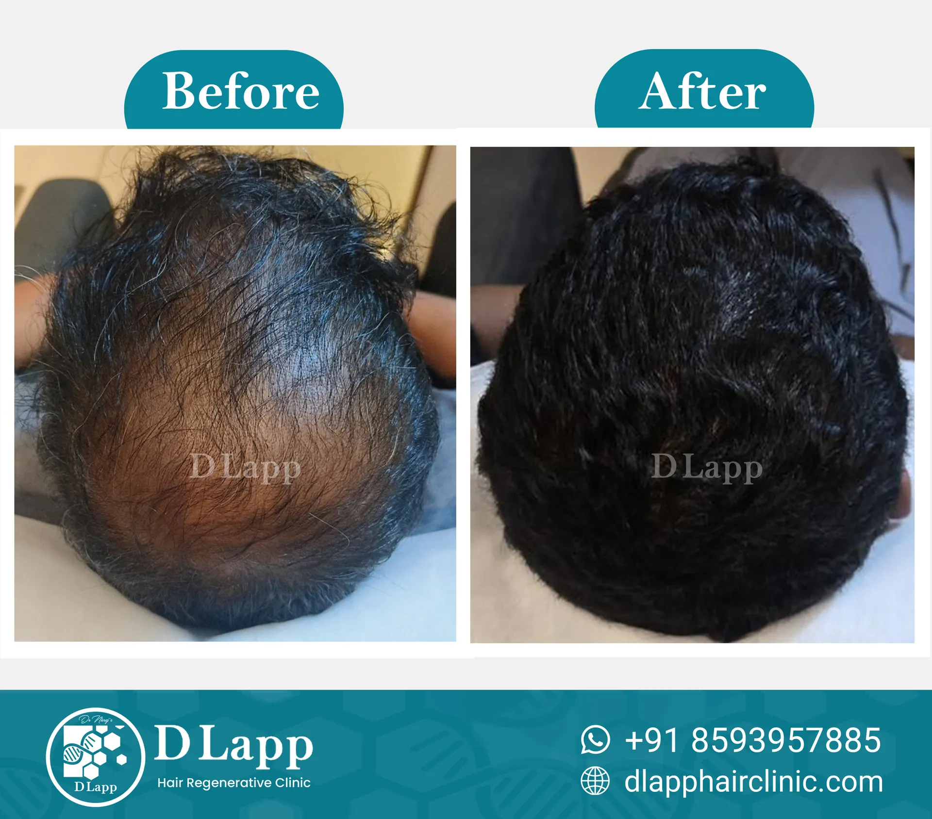 Before/After Medical Image