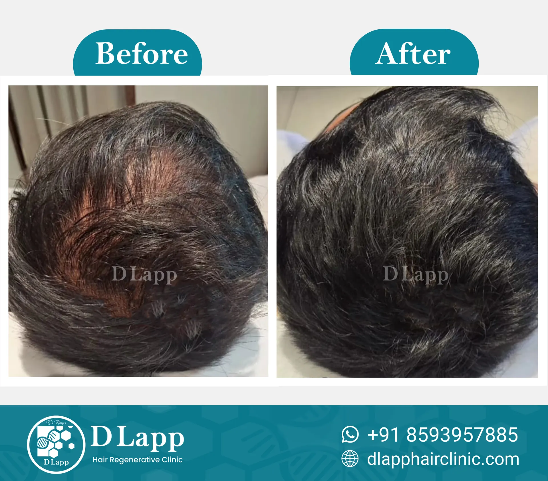 Before/After Medical Image