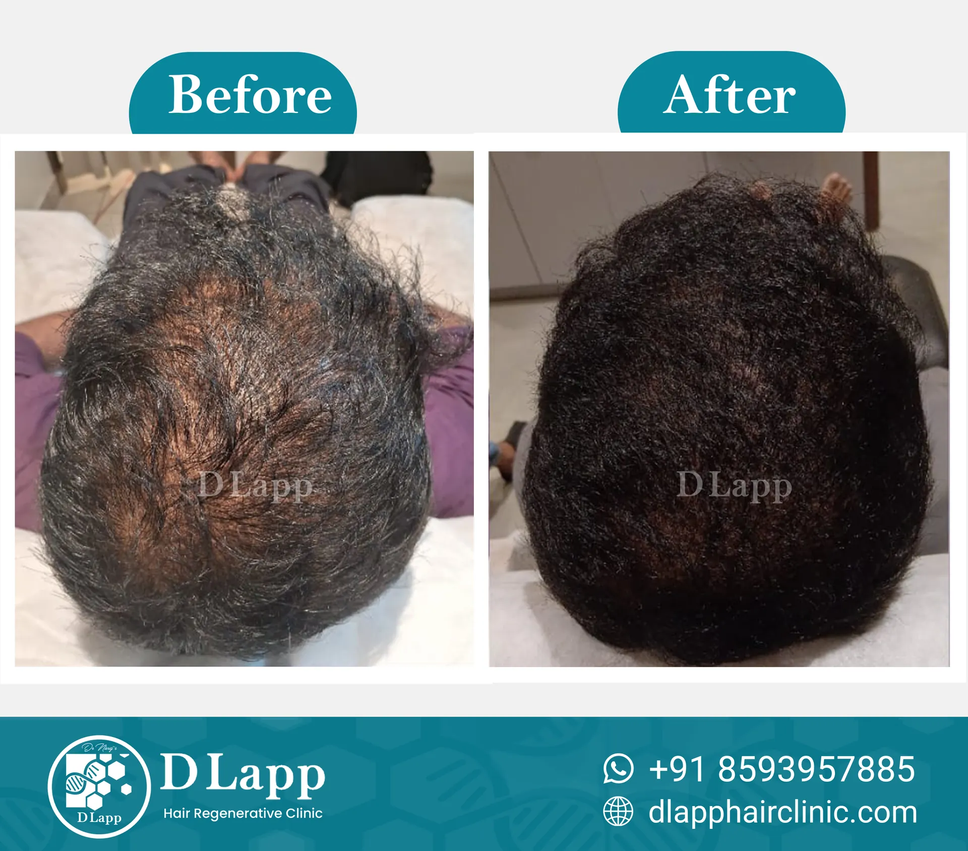 Before/After Medical Image
