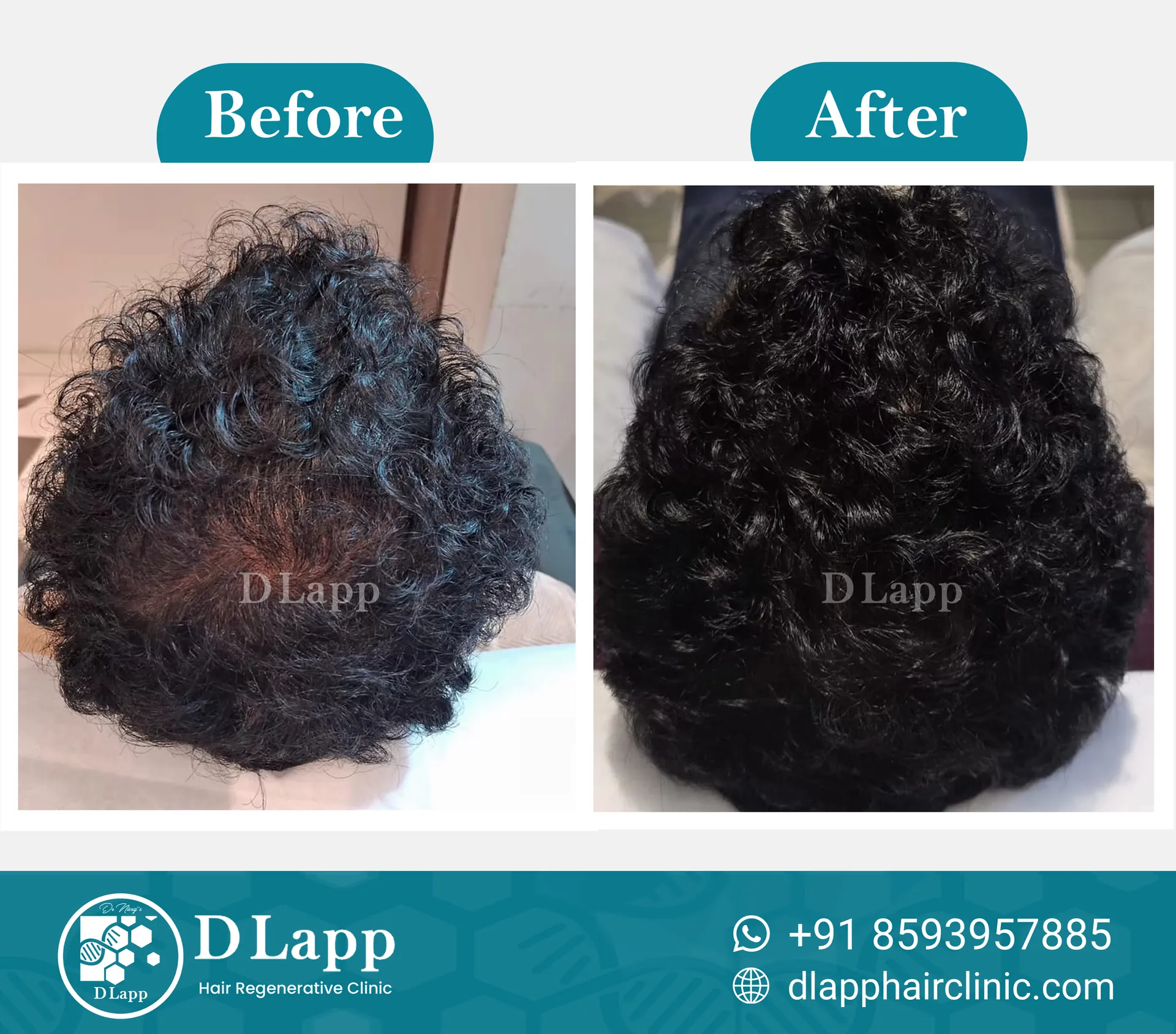 Before/After Medical Image