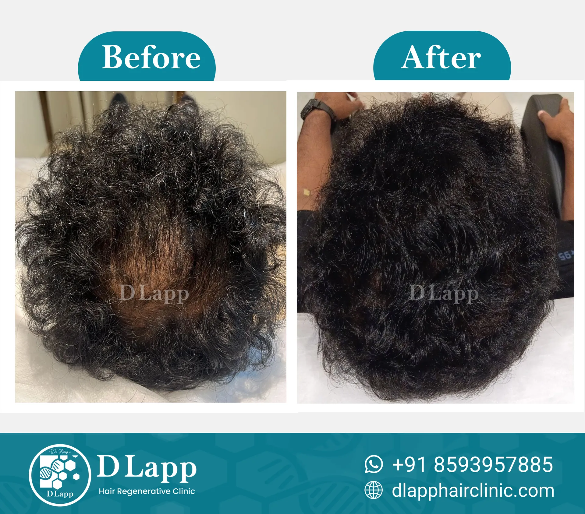 Before/After Medical Image