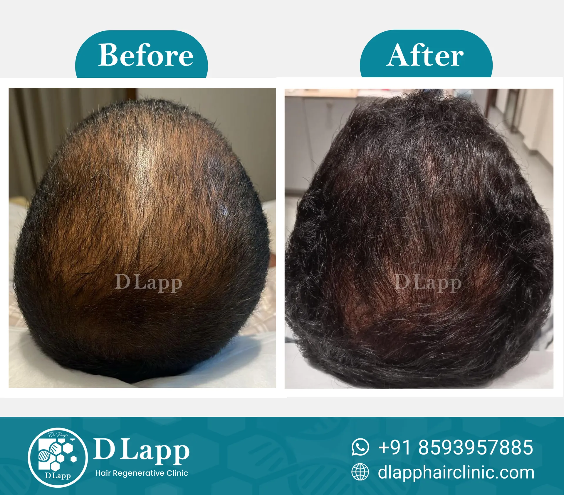 Before/After Medical Image