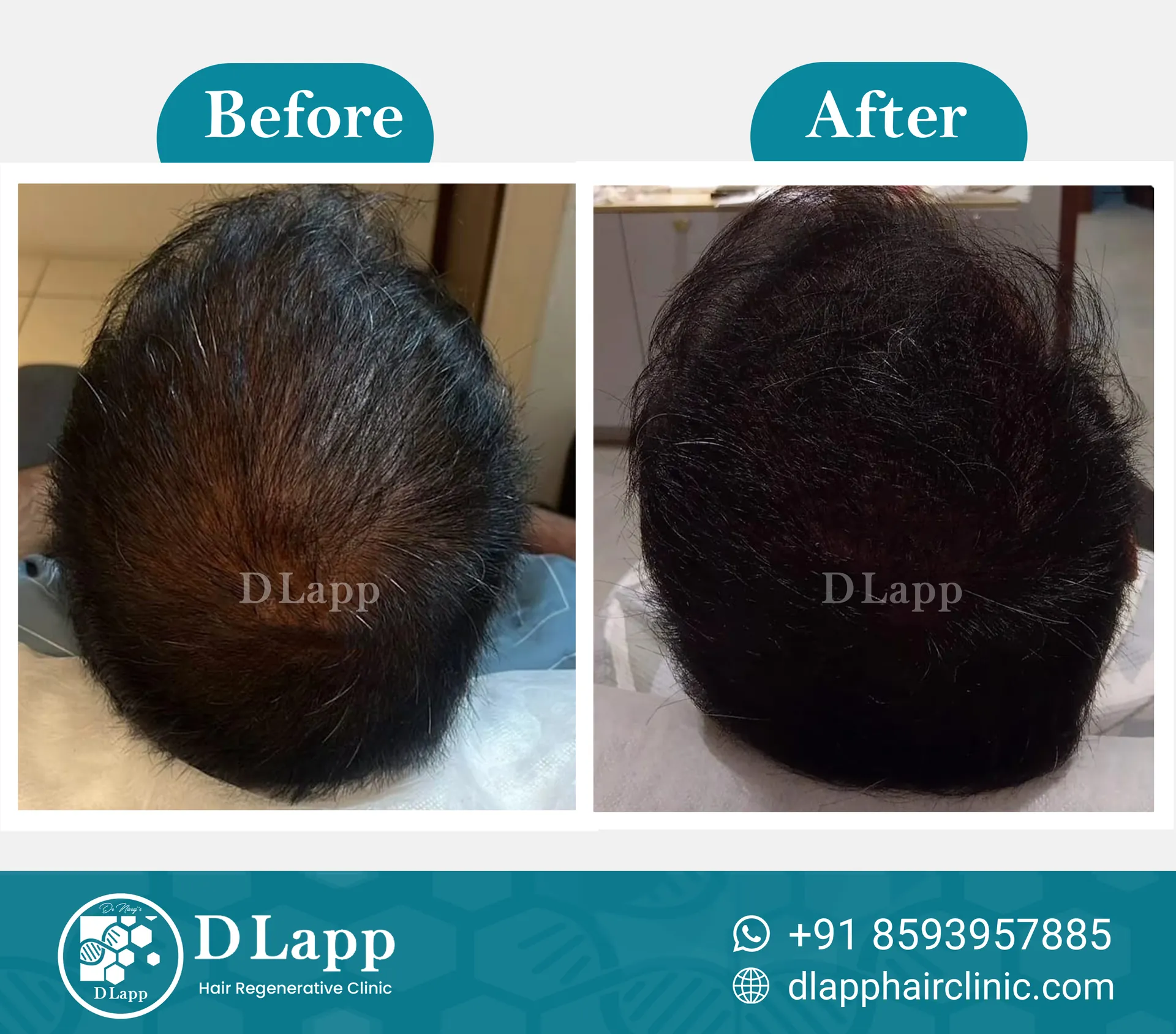 Before/After Medical Image