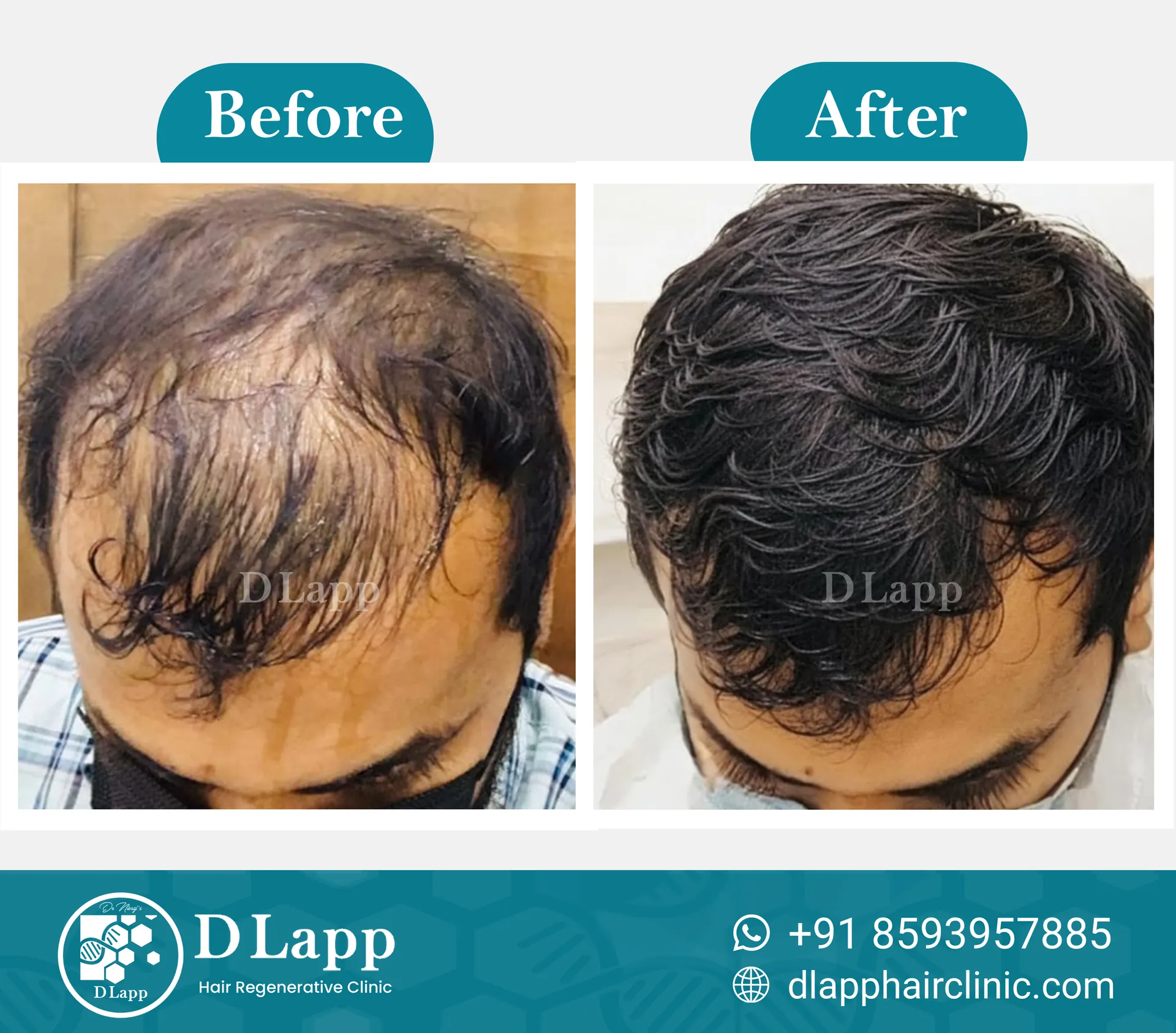 Before/After Medical Image