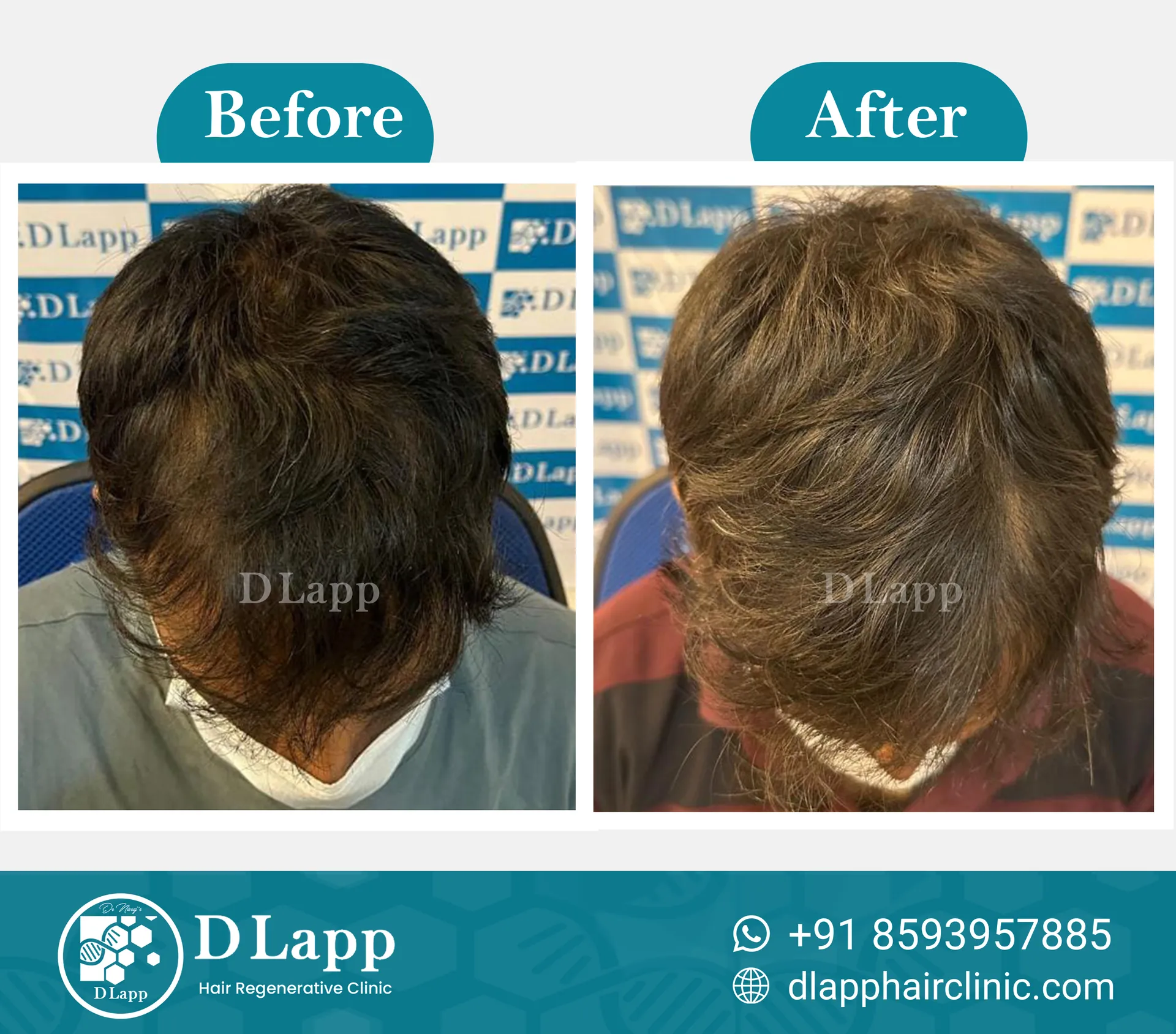 Before/After Medical Image